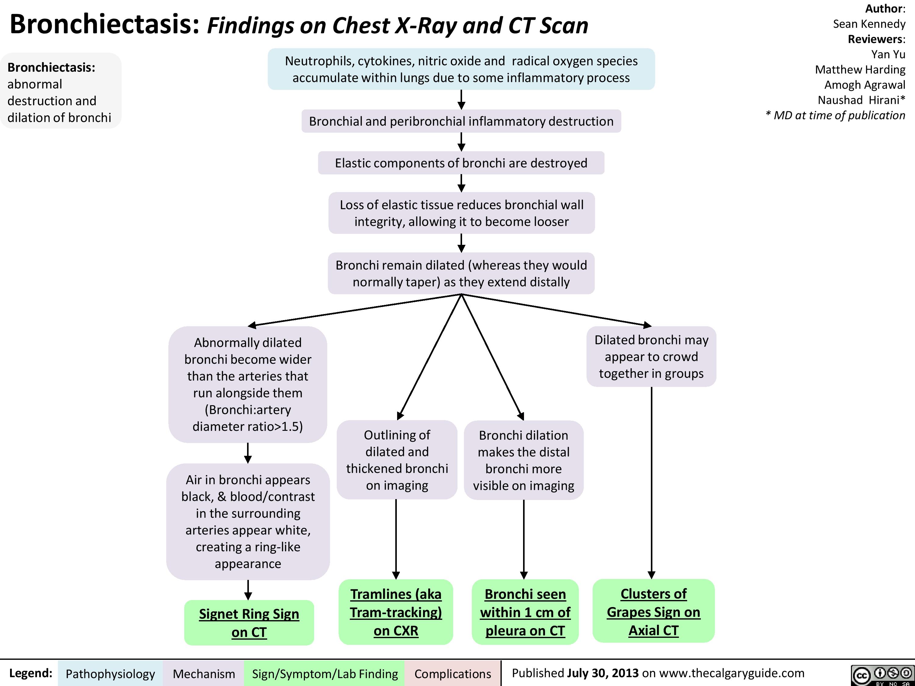 Bronchiectasis: Findings on Chest X-Ray and CT Scan
