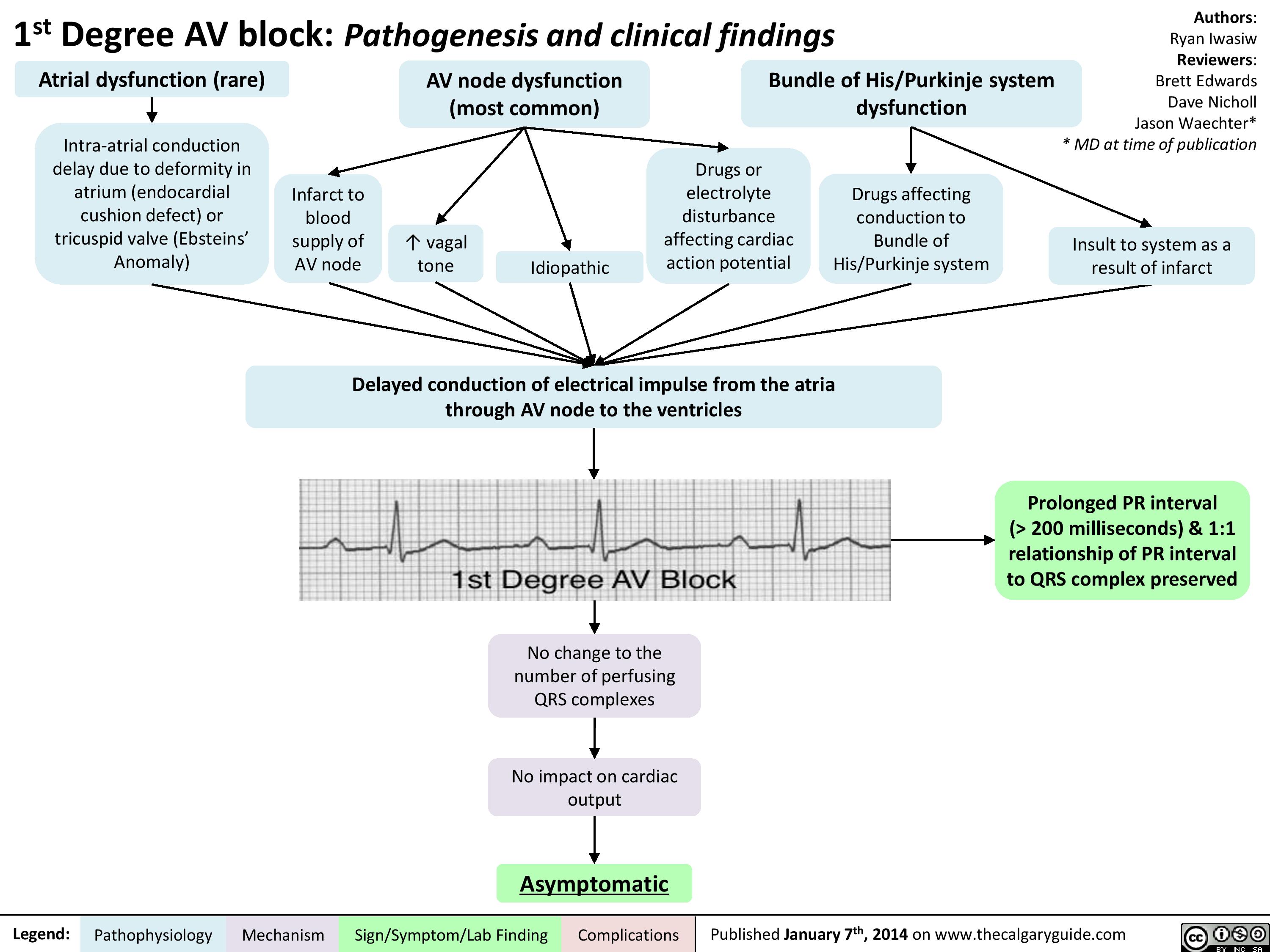 1st Degree AV Block Pathogenesis And Clinical Findings Calgary Guide