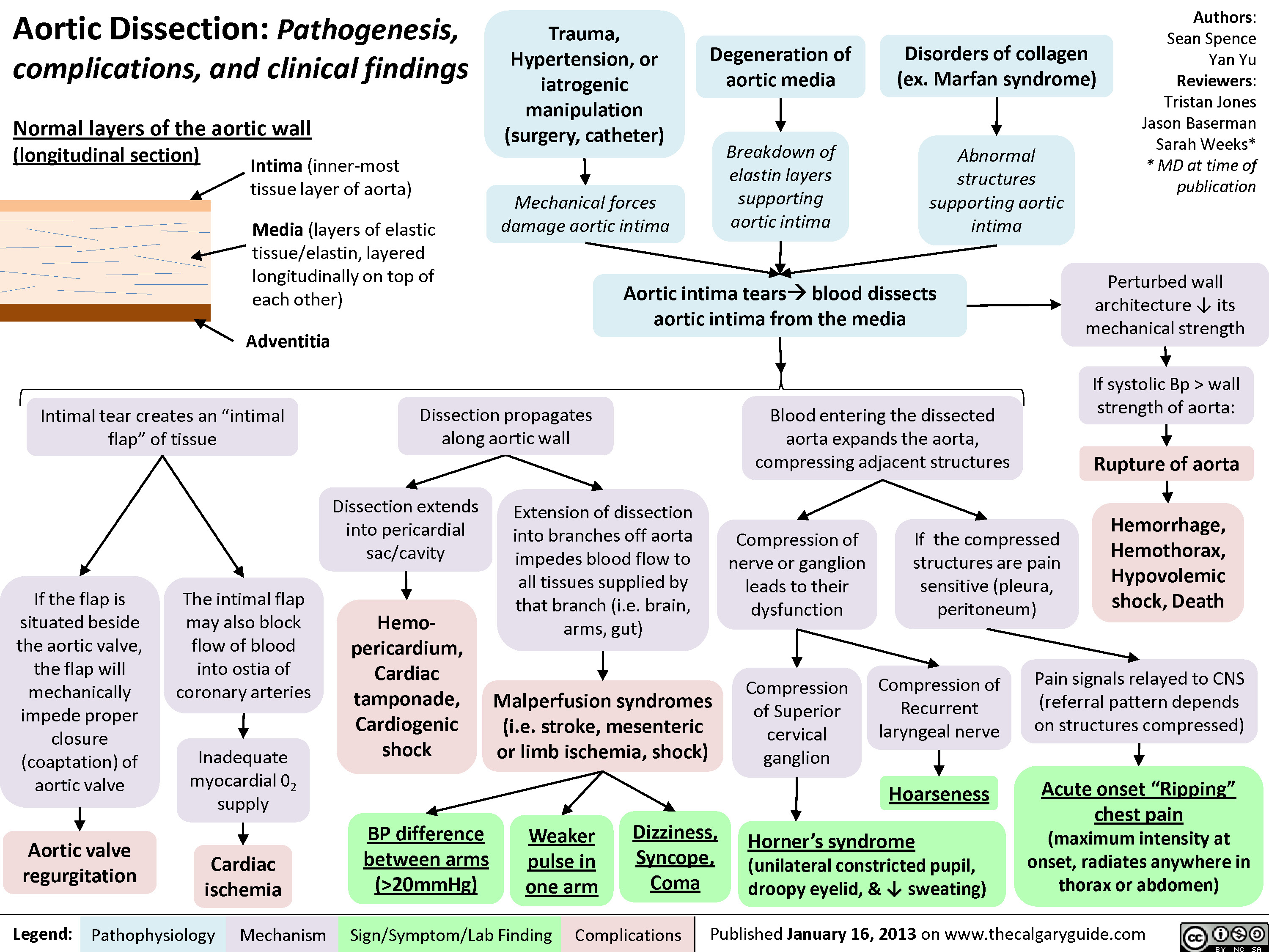 Aortic Dissection Calgary Guide