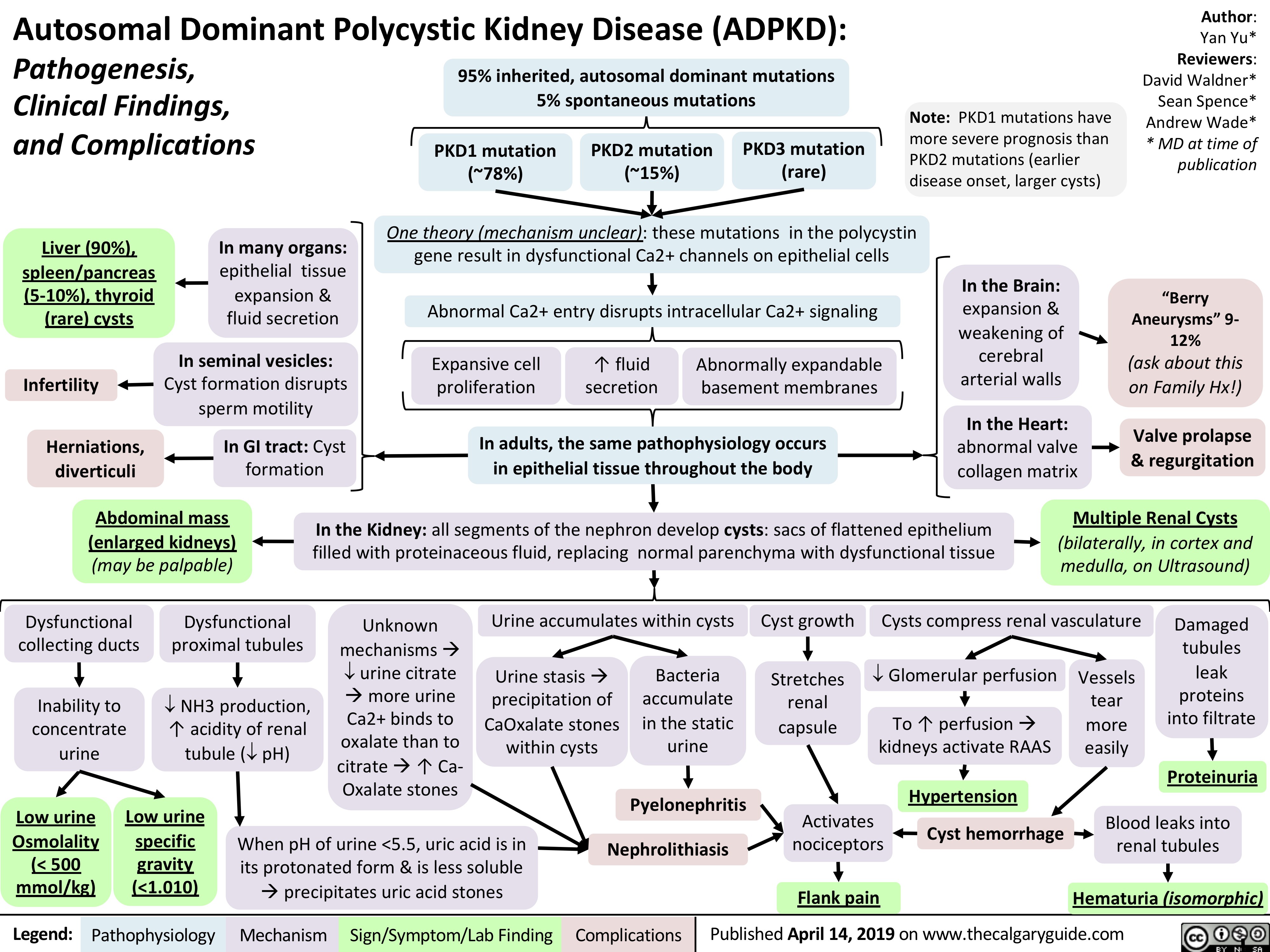 Autosomal Dominant Polycystic Kidney Disease (ADPKD):
Pathogenesis,
Clinical Findings,
and Complications
Author:
Yan Yu*
Reviewers:
David Waldner*
Sean Spence*
Andrew Wade*
* MD at time of
publication
Legend: Published April 14, 2019 on www.Pathophysiology Mechanism Sign/Symptom/Lab Finding Complications thecalgaryguide.com
One theory (mechanism unclear): these mutations in the polycystin
gene result in dysfunctional Ca2+ channels on epithelial cells
PKD1 mutation
(~78%)
Abnormal Ca2+ entry disrupts intracellular Ca2+ signaling
In the Kidney: all segments of the nephron develop cysts: sacs of flattened epithelium
filled with proteinaceous fluid, replacing normal parenchyma with dysfunctional tissue
PKD2 mutation
(~15%)
Expansive cell
proliferation
Low urine
Osmolality
(< 500
mmol/kg)
Abnormally expandable
basement membranes
PKD3 mutation
(rare)
↑ fluid
secretion
95% inherited, autosomal dominant mutations
5% spontaneous mutations
In adults, the same pathophysiology occurs
in epithelial tissue throughout the body
When pH of urine <5.5, uric acid is in
its protonated form & is less soluble
àprecipitates uric acid stones
Nephrolithiasis
Urine accumulates within cysts Cyst growth
Pyelonephritis
Damaged
tubules
leak
proteins
into filtrate
Proteinuria
Flank pain
Inability to
concentrate
urine
Low urine
specific
gravity
(<1.010)
¯ NH3 production,
↑ acidity of renal
tubule (¯ pH)
Activates
nociceptors Cyst hemorrhage
Urine stasis à
precipitation of
CaOxalate stones
within cysts
Multiple Renal Cysts
(bilaterally, in cortex and
medulla, on Ultrasound)
In the Brain:
expansion &
weakening of
cerebral
arterial walls
“Berry
Aneurysms” 9-
12%
(ask about this
on Family Hx!)
In many organs:
epithelial tissue
expansion &
fluid secretion
In the Heart:
abnormal valve
collagen matrix
Valve prolapse
& regurgitation
Liver (90%),
spleen/pancreas
(5-10%), thyroid
(rare) cysts
In seminal vesicles:
Cyst formation disrupts
sperm motility
Infertility
In GI tract: Cyst
formation
Herniations,
diverticuli
Dysfunctional
collecting ducts
Abdominal mass
(enlarged kidneys)
(may be palpable)
Blood leaks into
renal tubules
Hematuria (isomorphic)
Bacteria
accumulate
in the static
urine
Dysfunctional
proximal tubules
Unknown
mechanisms à
¯ urine citrate
àmore urine
Ca2+ binds to
oxalate than to
citrate à↑ Ca-
Oxalate stones
Note: PKD1 mutations have
more severe prognosis than
PKD2 mutations (earlier
disease onset, larger cysts)
Vessels
tear
more
easily
Stretches
renal
capsule
Cysts compress renal vasculature
¯ Glomerular perfusion
To ↑ perfusion à
kidneys activate RAAS
Hypertension