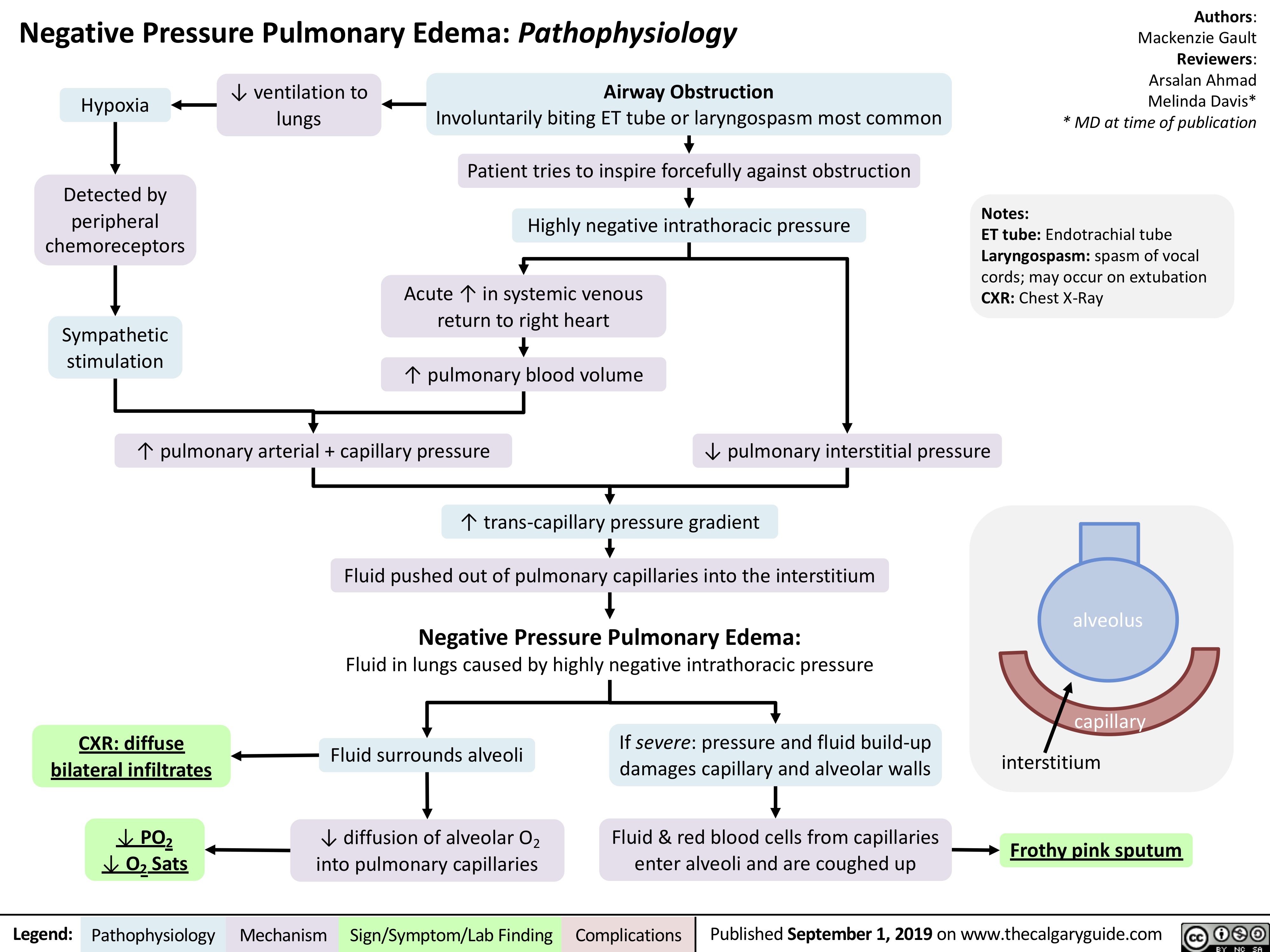 Negative Pressure Pulmonary Edema: Pathophysiology
Authors: Mackenzie Gault Reviewers: Arsalan Ahmad Melinda Davis* * MD at time of publication
Notes:
ET tube: Endotrachial tube Laryngospasm: spasm of vocal cords; may occur on extubation CXR: Chest X-Ray
   Hypoxia
Detected by peripheral chemoreceptors
Sympathetic stimulation
↓ ventilation to lungs
Airway Obstruction
Involuntarily biting ET tube or laryngospasm most common
Patient tries to inspire forcefully against obstruction
Highly negative intrathoracic pressure
Acute ↑ in systemic venous return to right heart
               ↑ pulmonary blood volume ↑ pulmonary arterial + capillary pressure
   ↓ pulmonary interstitial pressure ↑ trans-capillary pressure gradient
       Fluid pushed out of pulmonary capillaries into the interstitium
Negative Pressure Pulmonary Edema:
Fluid in lungs caused by highly negative intrathoracic pressure
alveolus capillary
interstitium
Frothy pink sputum
      CXR: diffuse bilateral infiltrates
↓ PO2 ↓ O2 Sats
Fluid surrounds alveoli
↓ diffusion of alveolar O2 into pulmonary capillaries
If severe: pressure and fluid build-up damages capillary and alveolar walls
Fluid & red blood cells from capillaries enter alveoli and are coughed up
                 Legend:
 Pathophysiology
 Mechanism
Sign/Symptom/Lab Finding
  Complications
Published September 1, 2019 on www.thecalgaryguide.com
   