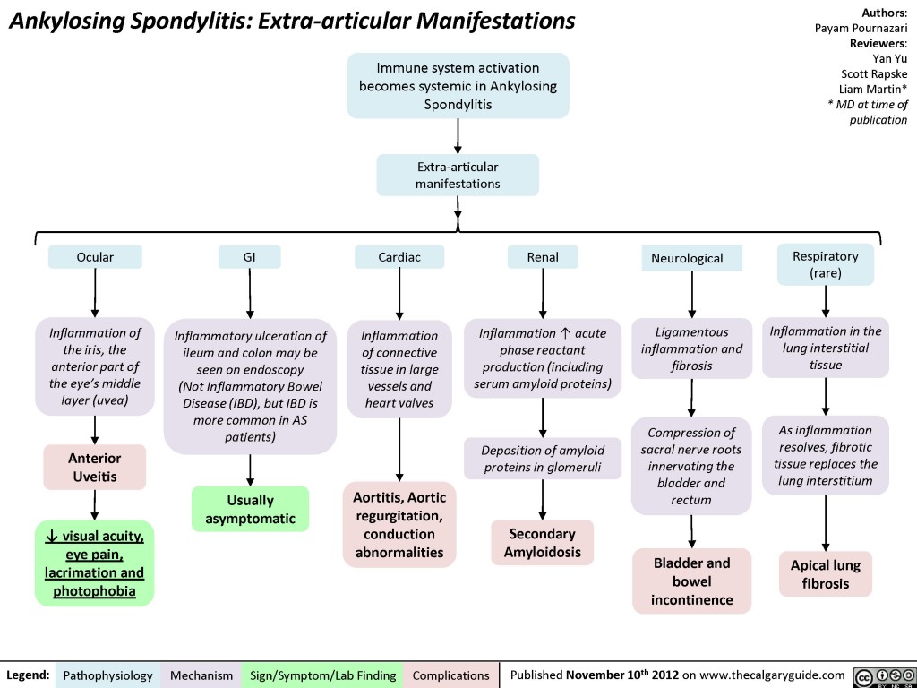 Ankylosing Spondylitis: Extra-articular Manifestations 