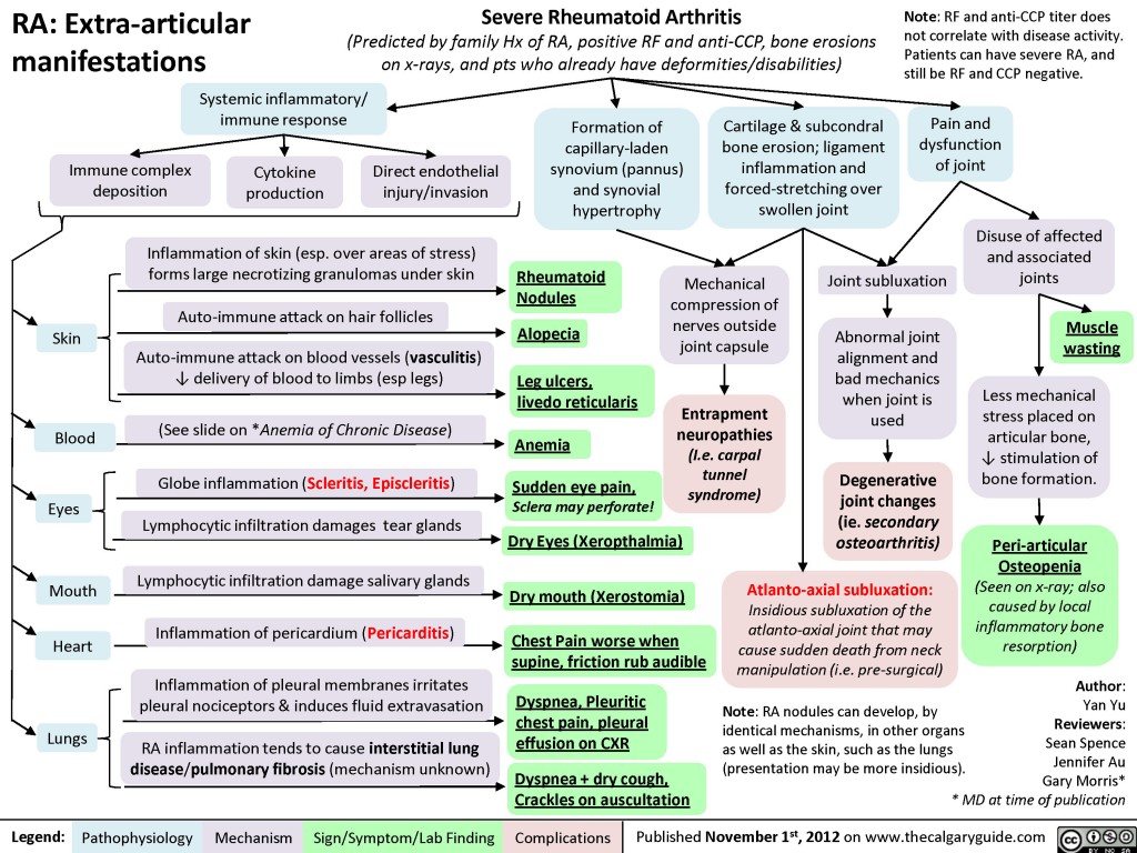 Rheumatoid arthritis (RA): Extra-articular manifestations | Calgary Guide