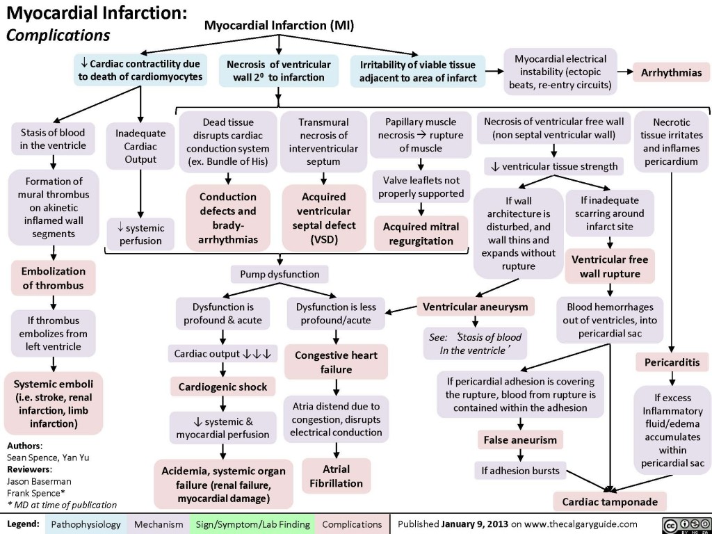 Myocardial Infarction: Complications | Calgary Guide