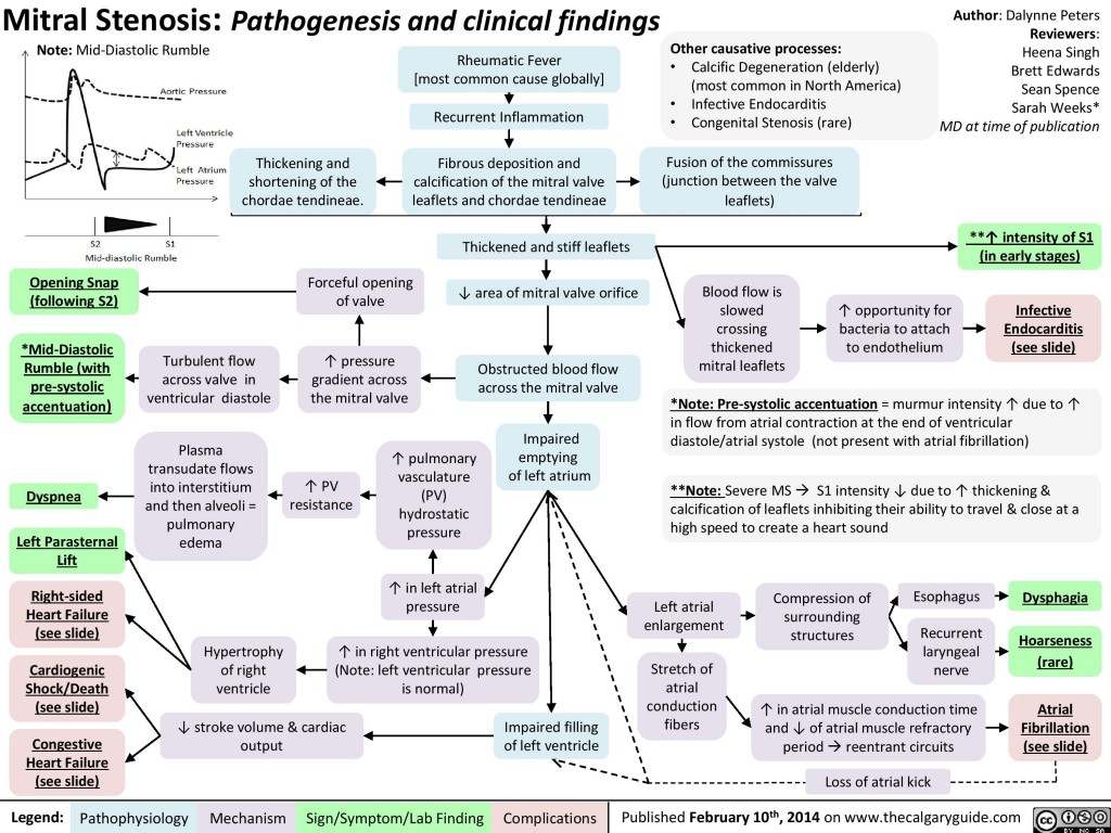 Mitral Stenosis Pathogenesis And Clinical Findings Calgary Guide