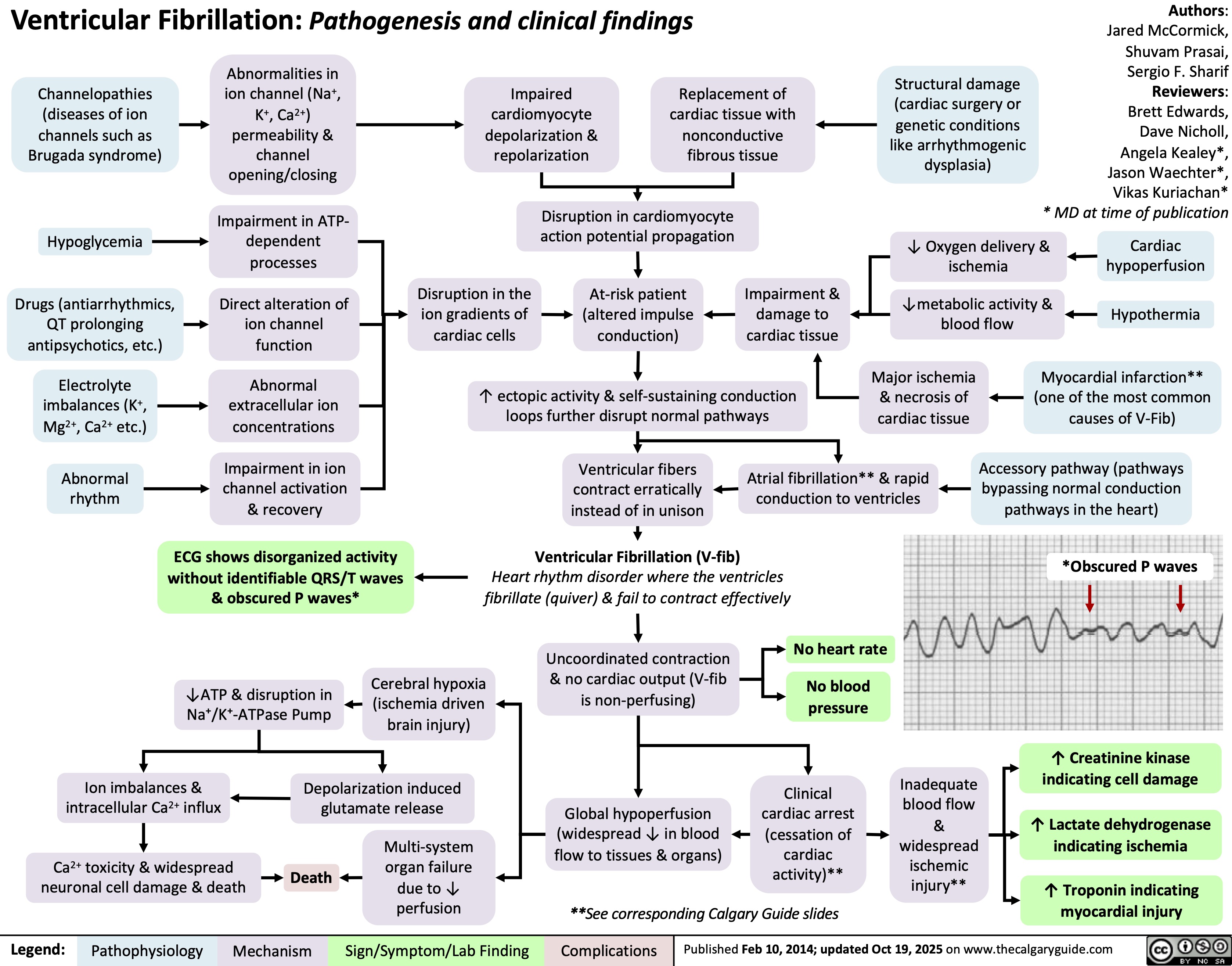 Ventricular Fibrillation: Pathogenesis and clinical findings
Channelopathies
(diseases of ion
channels such as
Brugada syndrome)
Abnormalities in
ion channel (Na+
,
K+, Ca2+)
permeability &
channel
opening/closing
Impaired
cardiomyocyte
depolarization &
repolarization
Replacement of
cardiac tissue with
nonconductive
fibrous tissue
Structural damage
(cardiac surgery or
genetic conditions
like arrhythmogenic
dysplasia)
Authors:
Jared McCormick,
Shuvam Prasai,
Sergio F. Sharif
Reviewers:
Brett Edwards,
Dave Nicholl,
Angela Kealey*,
Jason Waechter*,
Vikas Kuriachan*
* MD at time of publication
Hypoglycemia
Impairment in ATP-
dependent
processes
Disruption in cardiomyocyte
action potential propagation
↓ Oxygen delivery &
ischemia
Cardiac
hypoperfusion
Drugs (antiarrhythmics,
QT prolonging
antipsychotics, etc.)
Direct alteration of
ion channel
function
Disruption in the
ion gradients of
cardiac cells
At-risk patient
(altered impulse
conduction)
Impairment &
damage to
cardiac tissue
↓metabolic activity &
blood flow
Hypothermia
Electrolyte
imbalances (K+
,
Mg2+, Ca2+ etc.)
Abnormal
extracellular ion
concentrations
↑ ectopic activity & self-sustaining conduction
loops further disrupt normal pathways
Major ischemia
& necrosis of
cardiac tissue
Myocardial infarction**
(one of the most common
causes of V-Fib)
Abnormal
rhythm
Impairment in ion
channel activation
& recovery
Ventricular fibers
contract erratically
instead of in unison
Atrial fibrillation** & rapid
conduction to ventricles
Accessory pathway (pathways
bypassing normal conduction
pathways in the heart)
ECG shows disorganized activity
without identifiable QRS/T waves
& obscured P waves*
Ventricular Fibrillation (V-fib)
Heart rhythm disorder where the ventricles
fibrillate (quiver) & fail to contract effectively
*Obscured P waves
No heart rate
↓ATP & disruption in
Na⁺/K⁺-ATPase Pump
Cerebral hypoxia
(ischemia driven
brain injury)
Uncoordinated contraction
& no cardiac output (V-fib
is non-perfusing)
No blood
pressure
↑ Creatinine kinase
indicating cell damage
Ion imbalances &
intracellular Ca2+ influx
Depolarization induced
glutamate release
Global hypoperfusion
(widespread ↓ in blood
flow to tissues & organs)
Ca2+ toxicity & widespread
neuronal cell damage & death
Death
Multi-system
organ failure
due to ↓
perfusion
Clinical
cardiac arrest
(cessation of
cardiac
activity)**
Inadequate
blood flow
&
widespread
ischemic
injury**
↑ Lactate dehydrogenase
indicating ischemia
**See corresponding Calgary Guide slides
↑ Troponin indicating
myocardial injury
Legend: Published Feb 10, 2014; updated Oct 19, 2025 on www.thecalgaryguide.com
Pathophysiology Mechanism
Sign/Symptom/Lab Finding Complications
