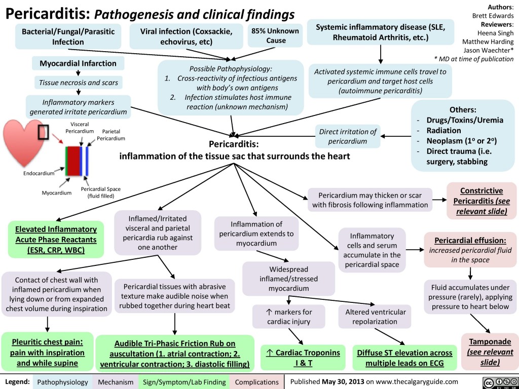 Pericarditis pathogenesis and clinical findings calgary guide