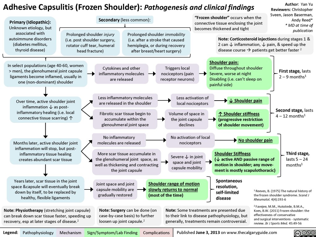 Adhesive Capsulitis Calgary Guide