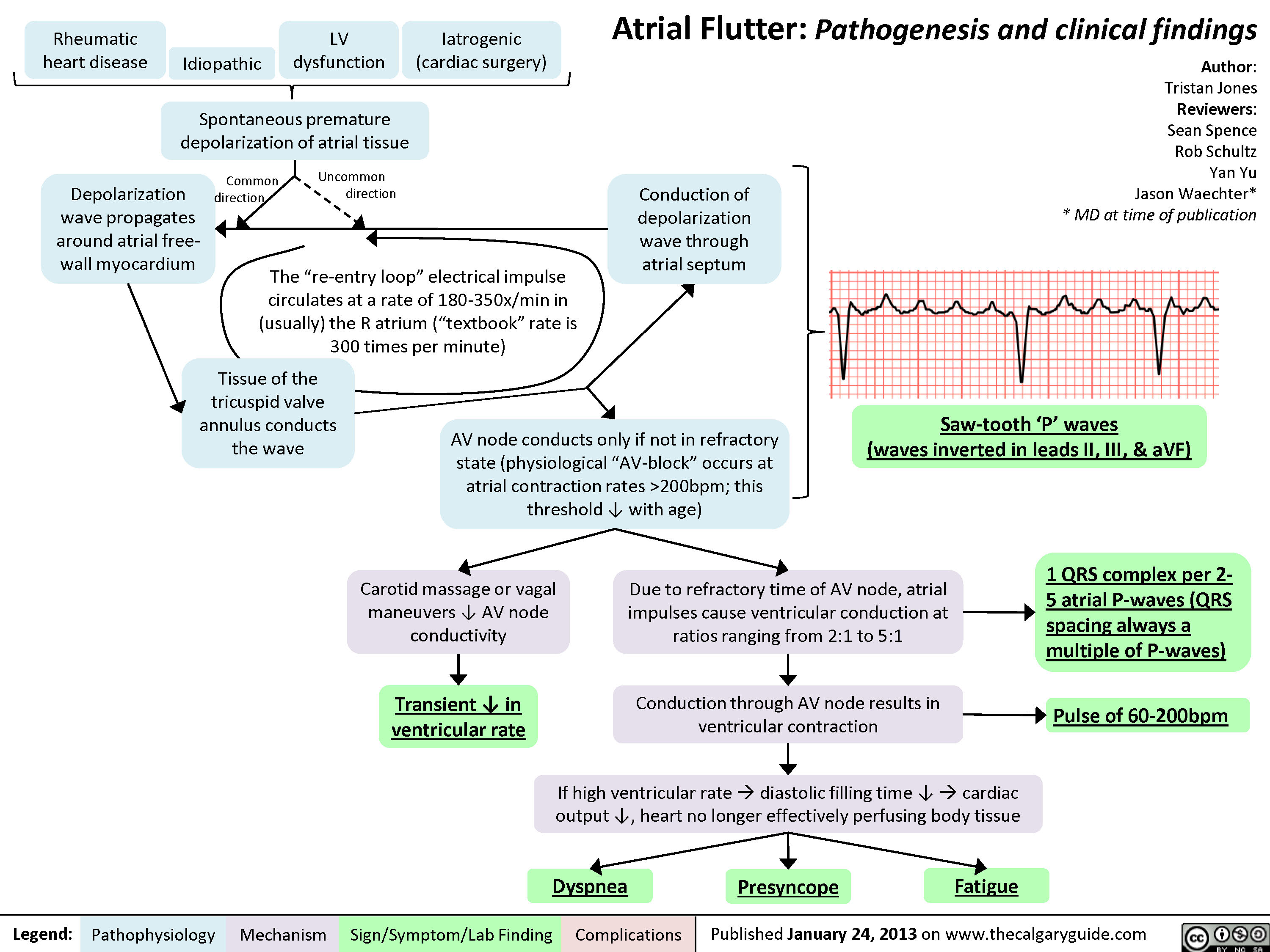 Atrial Flutter 1 Calgary Guide