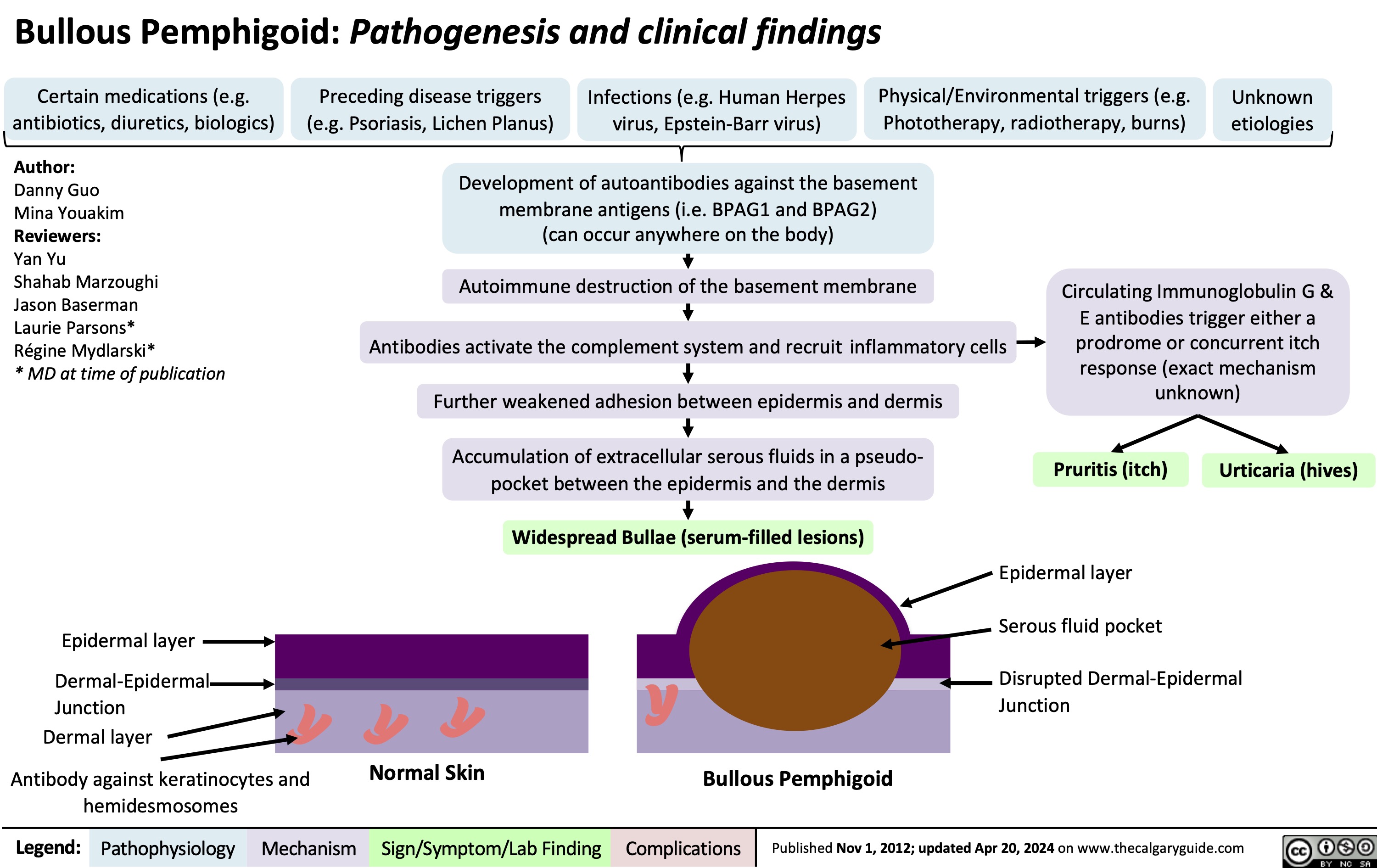 Bullous Pemphigoid: Pathogenesis and clinical findings
     Certain medications (e.g. antibiotics, diuretics, biologics)
Author:
Danny Guo
Mina Youakim
Reviewers:
Yan Yu
Shahab Marzoughi
Jason Baserman
Laurie Parsons*
Régine Mydlarski*
* MD at time of publication
Preceding disease triggers Infections (e.g. Human Herpes Physical/Environmental triggers (e.g. (e.g. Psoriasis, Lichen Planus) virus, Epstein-Barr virus) Phototherapy, radiotherapy, burns)
Development of autoantibodies against the basement membrane antigens (i.e. BPAG1 and BPAG2) (can occur anywhere on the body)
Autoimmune destruction of the basement membrane
Antibodies activate the complement system and recruit inflammatory cells Further weakened adhesion between epidermis and dermis
Accumulation of extracellular serous fluids in a pseudo- pocket between the epidermis and the dermis
Unknown etiologies
    Circulating Immunoglobulin G & E antibodies trigger either a prodrome or concurrent itch response (exact mechanism unknown)
       Pruritis (itch)
Epidermal layer Serous fluid pocket
Urticaria (hives)
 Widespread Bullae (serum-filled lesions)
  Epidermal layer
Dermal-Epidermal
Junction Dermal layer
Antibody against keratinocytes and
Disrupted Dermal-Epidermal Junction
    Y
   hemidesmosomes
Normal Skin
Bullous Pemphigoid
 Legend:
 Pathophysiology
 Mechanism
Sign/Symptom/Lab Finding
 Complications
 Published Nov 1, 2012; updated Apr 20, 2024 on www.thecalgaryguide.com
 Y Y
Y
 