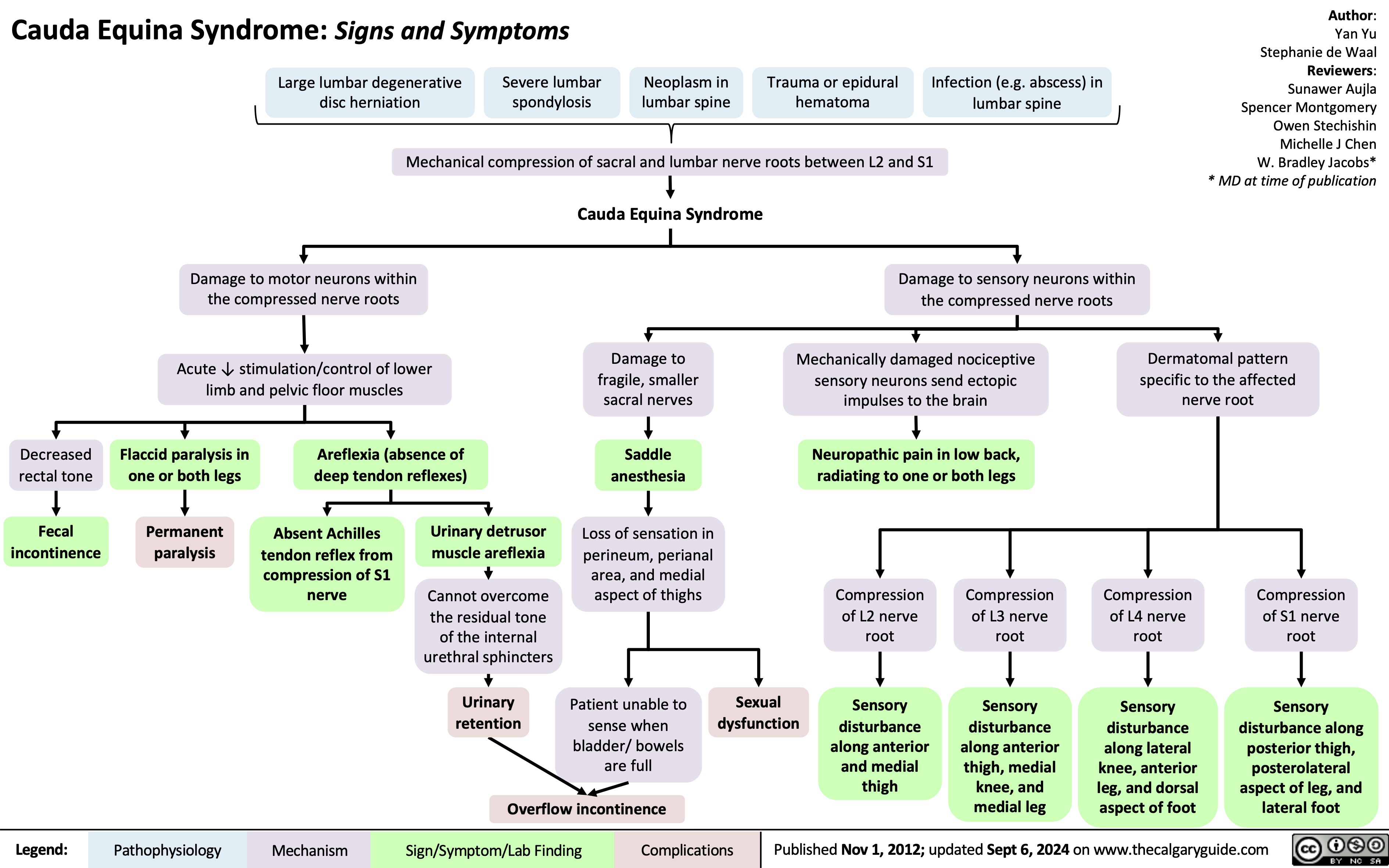 Cauda Equina Syndrome: Signs and Symptoms
Author: Yan Yu Stephanie de Waal Reviewers: Sunawer Aujla Spencer Montgomery Owen Stechishin Michelle J Chen W. Bradley Jacobs* * MD at time of publication
     Large lumbar degenerative disc herniation
Severe lumbar spondylosis
Neoplasm in lumbar spine
Trauma or epidural hematoma
Infection (e.g. abscess) in lumbar spine
  Mechanical compression of sacral and lumbar nerve roots between L2 and S1
Cauda Equina Syndrome
    Damage to motor neurons within the compressed nerve roots
Acute ↓ stimulation/control of lower limb and pelvic floor muscles
Damage to fragile, smaller sacral nerves
Saddle anesthesia
Loss of sensation in perineum, perianal
area, and medial aspect of thighs
Patient unable to sense when bladder/ bowels are full
Damage to sensory neurons within the compressed nerve roots
Mechanically damaged nociceptive sensory neurons send ectopic impulses to the brain
Neuropathic pain in low back, radiating to one or both legs
Dermatomal pattern specific to the affected nerve root
            Decreased rectal tone
Fecal incontinence
Flaccid paralysis in one or both legs
Permanent paralysis
Areflexia (absence of deep tendon reflexes)
       Absent Achilles tendon reflex from compression of S1 nerve
Urinary detrusor muscle areflexia
Cannot overcome the residual tone of the internal urethral sphincters
Urinary retention
Compression of L2 nerve root
Sensory disturbance
along anterior and medial thigh
Compression of L3 nerve root
Sensory disturbance along anterior thigh, medial knee, and medial leg
Compression of L4 nerve root
Sensory disturbance along lateral knee, anterior leg, and dorsal aspect of foot
Compression of S1 nerve root
Sensory disturbance along posterior thigh, posterolateral aspect of leg, and lateral foot
             Sexual dysfunction
  Overflow incontinence
Legend:
Pathophysiology
Mechanism
Sign/Symptom/Lab Finding
Complications
 Published Nov 1, 2012; updated Sept 6, 2024 on www.thecalgaryguide.com