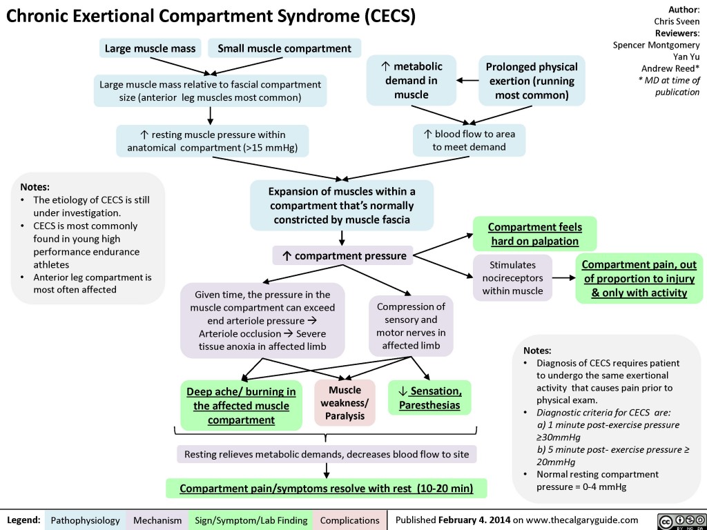 Chronic Exertional Compartment Syndrome | Calgary Guide