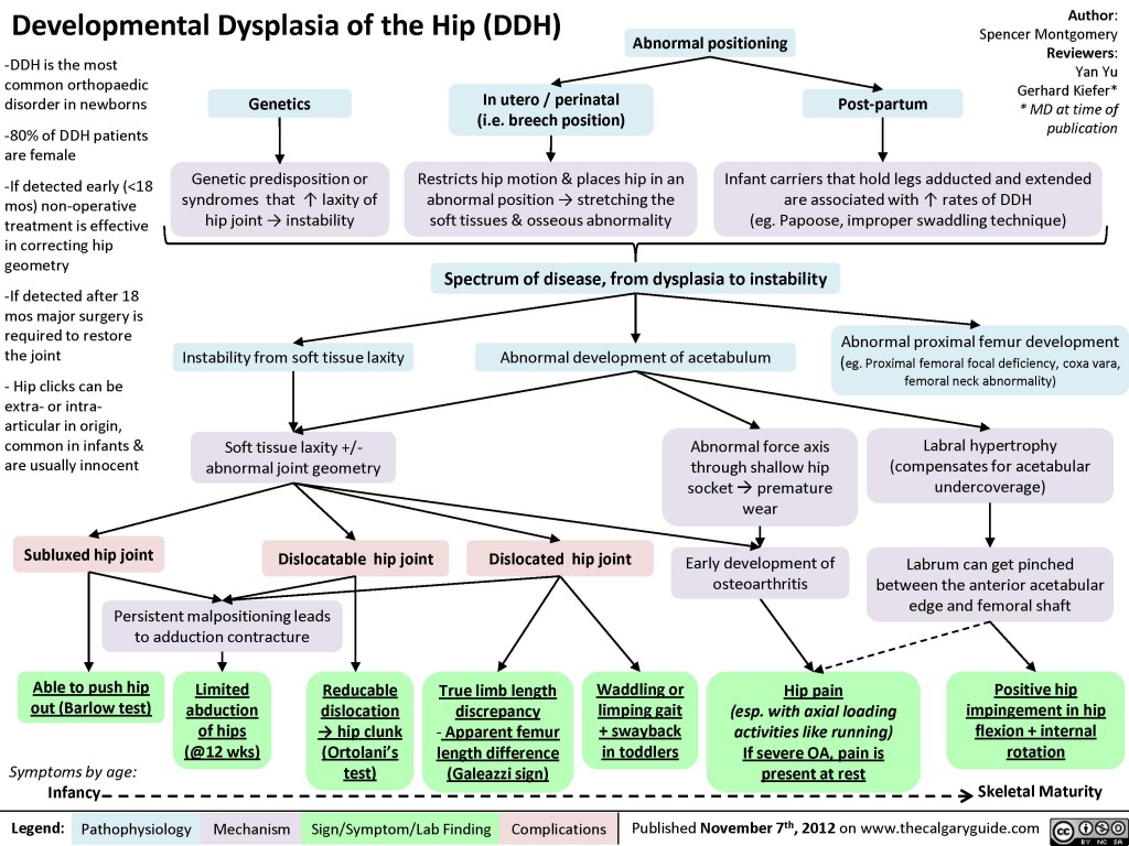 Developmental Dysplasia of the Hip (DDH) | Calgary Guide