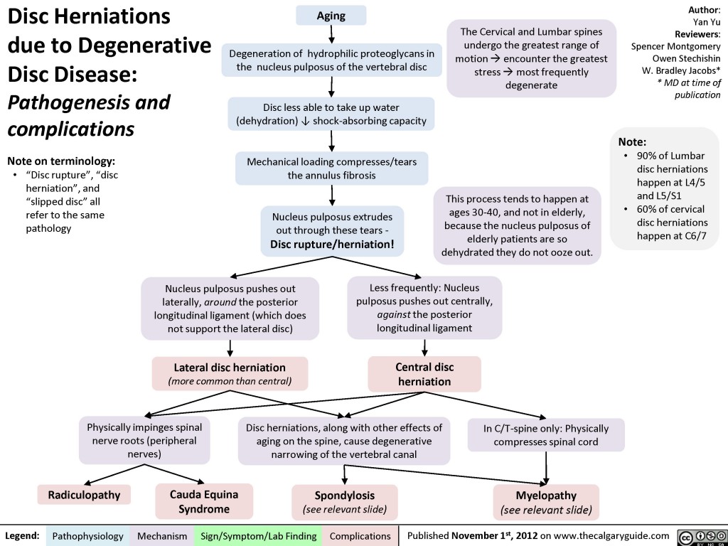 Disc Herniations | Calgary Guide