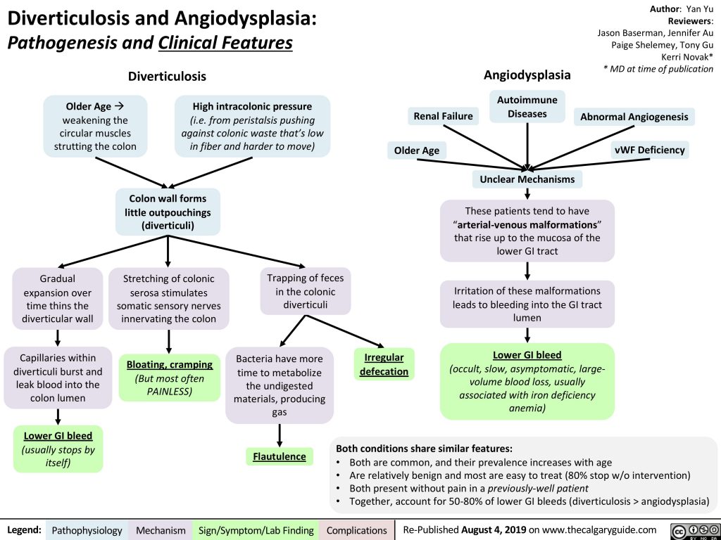 Diverticulosis and Angiodysplasia | Calgary Guide