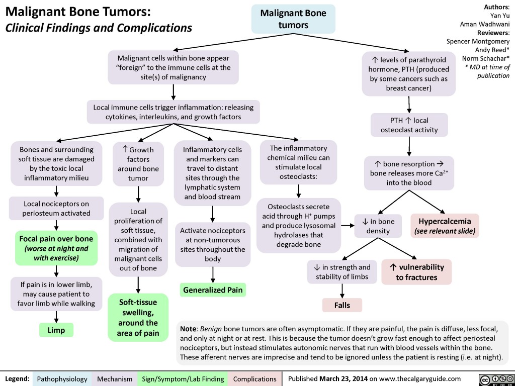 Malignant Bone Tumors Clinical Findings And Complications Calgary Guide