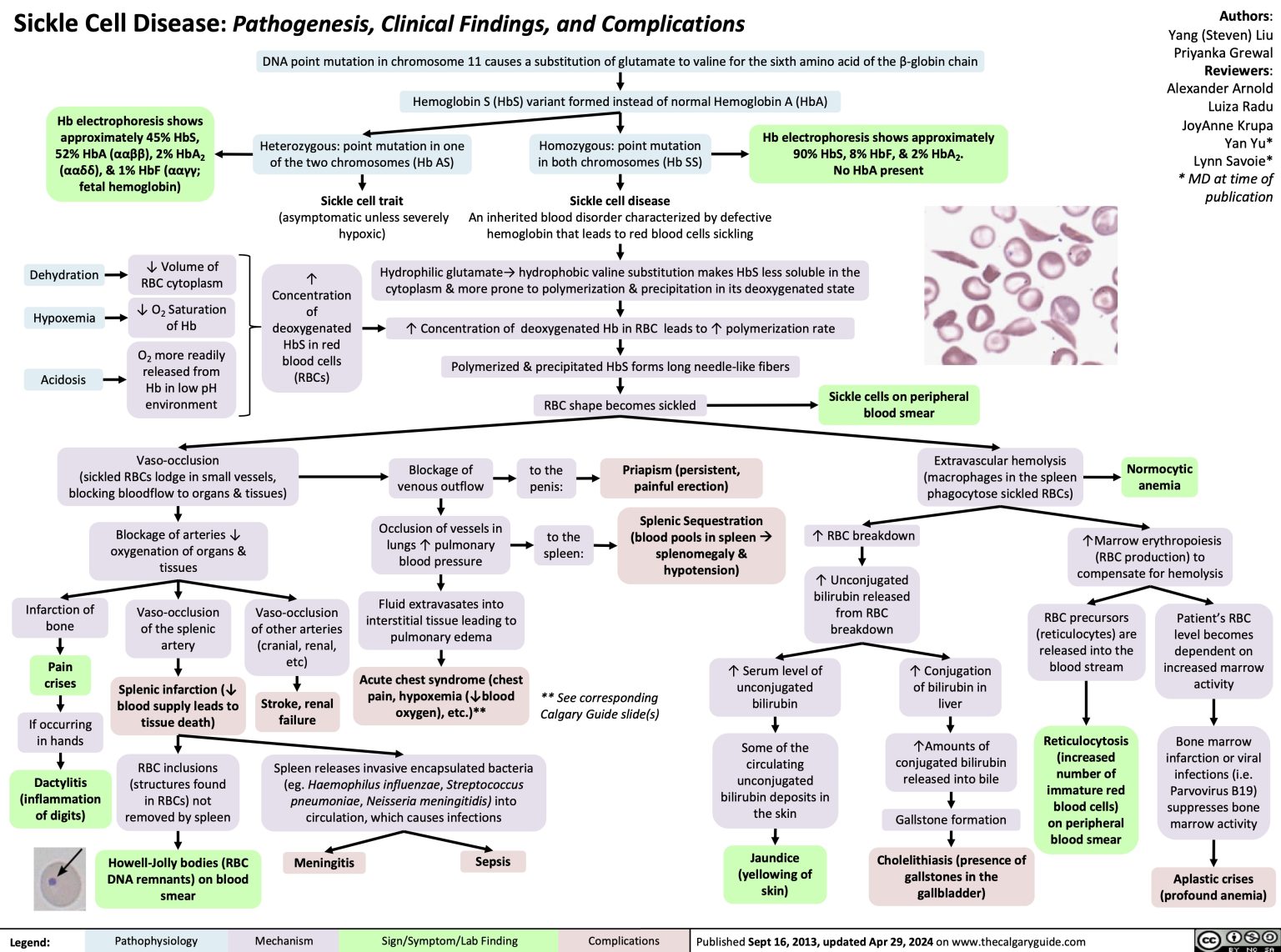 Sickle Cell Disease Pathogenesis Clinical Findings And Complications ...