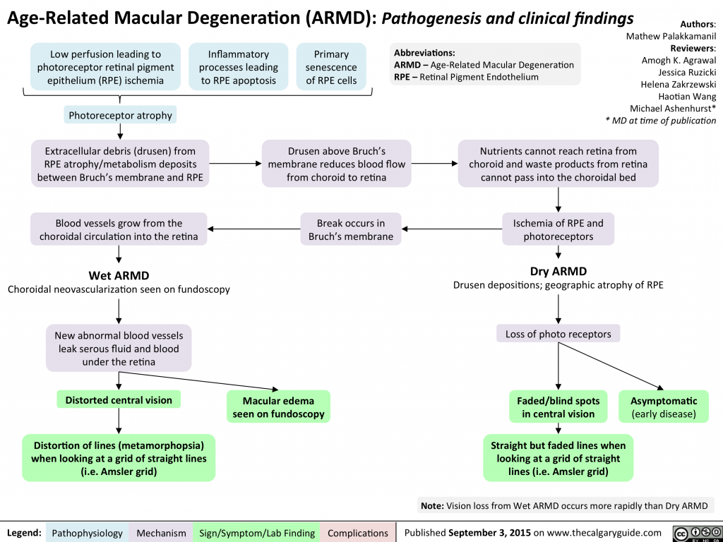 Age Related Macular Degeneration: Pathogenesis and clinical findings ...