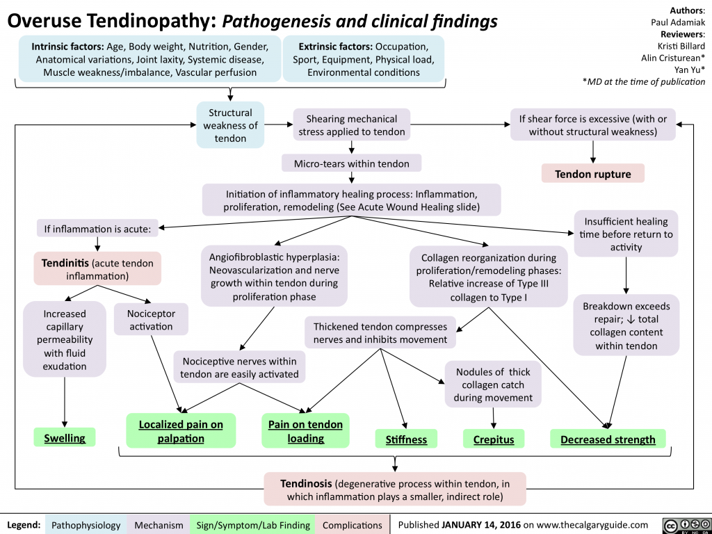 Overuse Tendinopathy: Pathogenesis and clinical findings | Calgary Guide