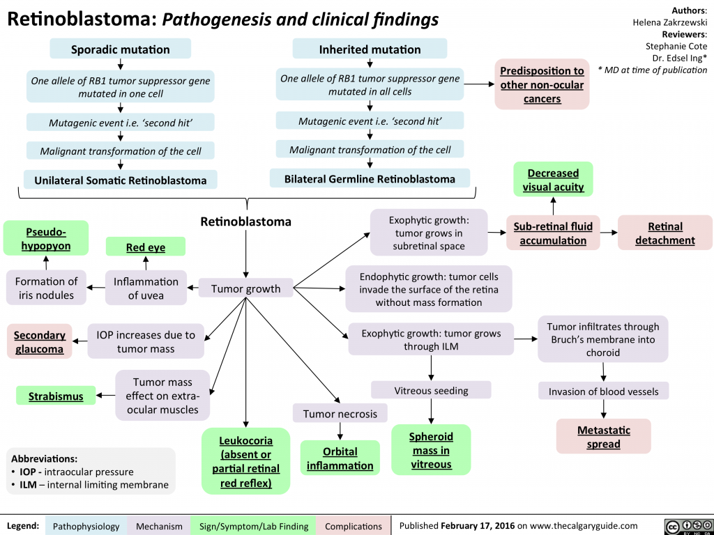 Retinoblastoma: Pathogenesis and clinical findings | Calgary Guide