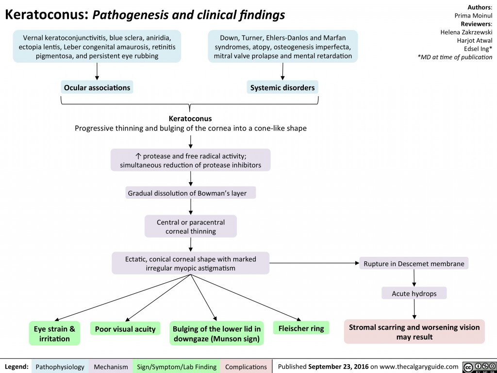 literature review keratoconus