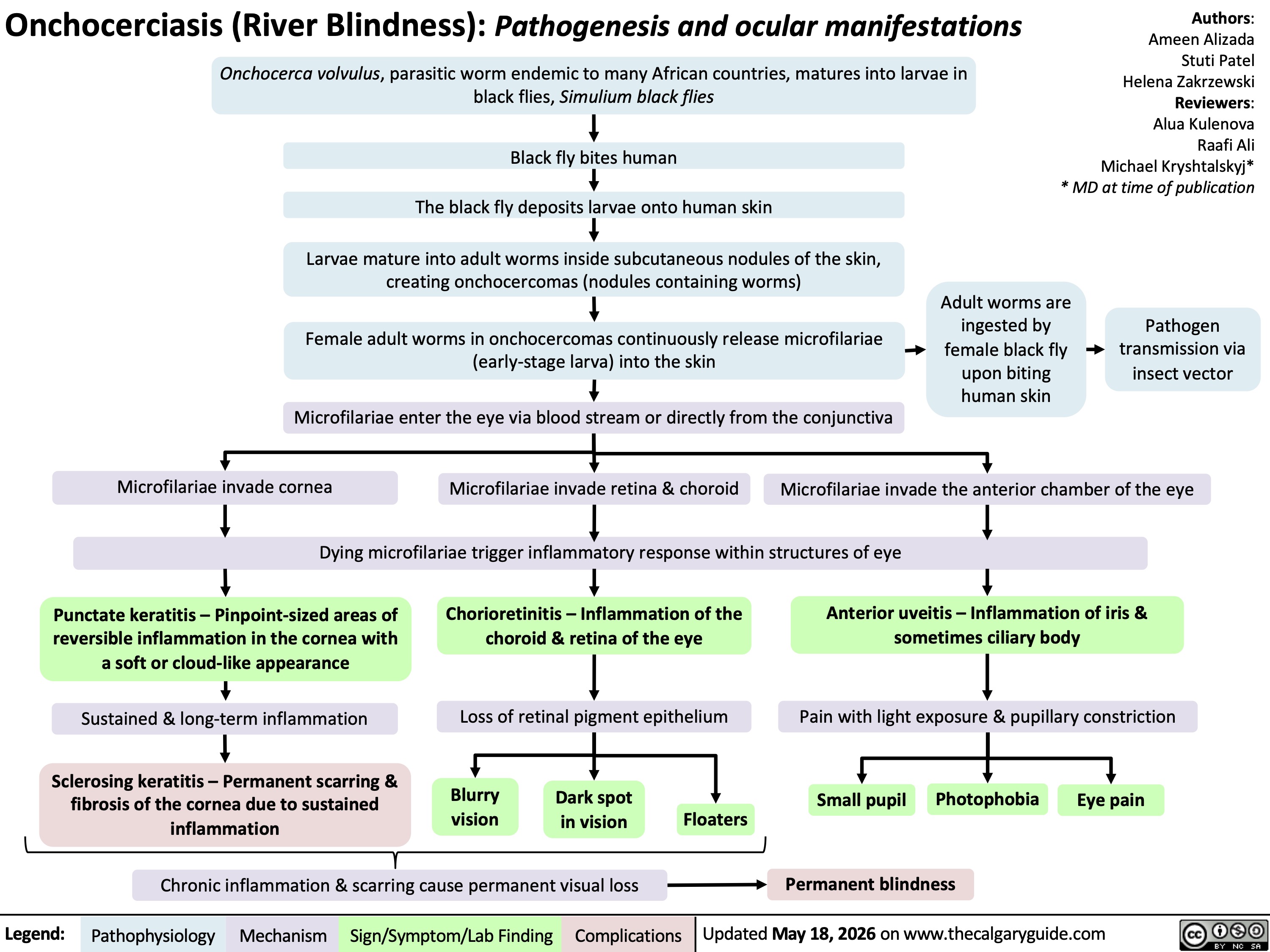 Onchocerciasis (River Blindness): Pathogenesis and ocular manifestations
Onchocerca volvulus, parasitic worm endemic to many African countries, matures into larvae in
black flies, Simulium black flies
Black fly bites human
The black fly deposits larvae onto human skin
Larvae mature into adult worms inside subcutaneous nodules of the skin,
creating onchocercomas (nodules containing worms)
Female adult worms in onchocercomas continuously release microfilariae
(early-stage larva) into the skin
Adult worms are
ingested by
female black fly
upon biting
human skin
Microfilariae enter the eye via blood stream or directly from the conjunctiva
Authors:
Ameen Alizada
Stuti Patel
Helena Zakrzewski
Reviewers:
Alua Kulenova
Raafi Ali
Michael Kryshtalskyj*
* MD at time of publication
Pathogen
transmission via
insect vector
Microfilariae invade cornea
Microfilariae invade retina & choroid
Dying microfilariae trigger inflammatory response within structures of eye
Microfilariae invade the anterior chamber of the eye
Anterior uveitis – Inflammation of iris &
sometimes ciliary body
Punctate keratitis – Pinpoint-sized areas of
reversible inflammation in the cornea with
a soft or cloud-like appearance
Sustained & long-term inflammation
Sclerosing keratitis – Permanent scarring &
fibrosis of the cornea due to sustained
inflammation
Chorioretinitis – Inflammation of the
choroid & retina of the eye
Loss of retinal pigment epithelium Blurry
vision
Dark spot
in vision
Floaters
Chronic inflammation & scarring cause permanent visual loss
Pain with light exposure & pupillary constriction
Small pupil
Photophobia
Eye pain
Legend: Pathophysiology Mechanism
Sign/Symptom/Lab Finding Complications
Permanent blindness
Updated May 18, 2026 on www.thecalgaryguide.com
