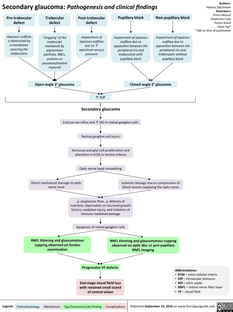 Secondary Glaucoma: Pathogenesis and Clinical Findings | Calgary Guide