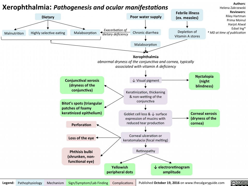 Xeropthalmia: Pathogenesis and Ocular Manifestations | Calgary Guide