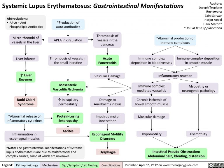 SLE-GI Manifestations | Calgary Guide