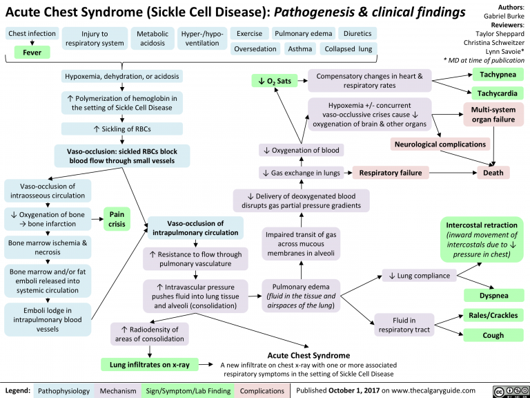 Acute Chest Syndrome (Sickle Cell Disease) | Calgary Guide