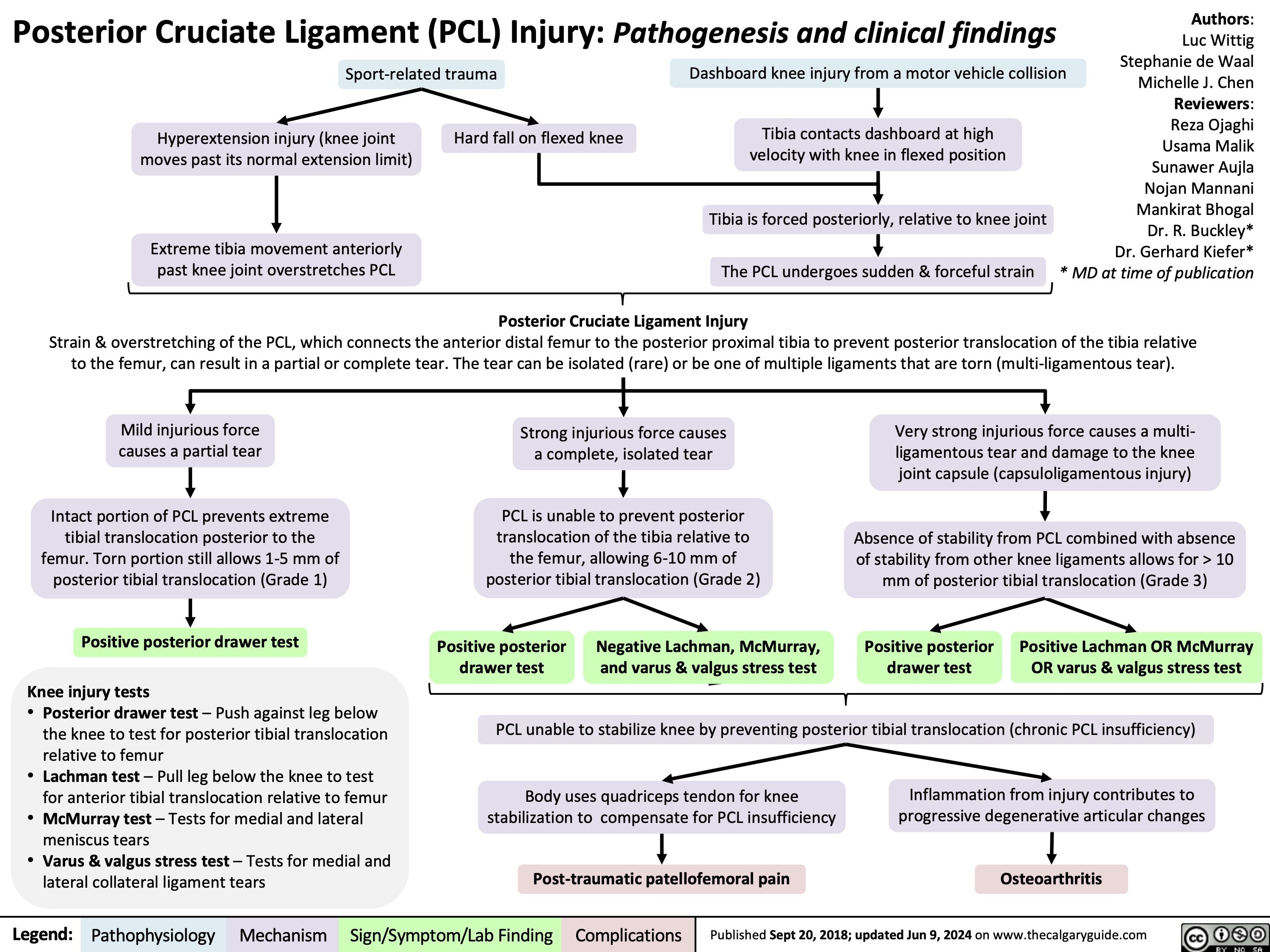 Posterior Cruciate Ligament (PCL) Injury: Pathogenesis and clinical findings
Authors: Luc Wittig Stephanie de Waal Michelle J. Chen Reviewers: Reza Ojaghi Usama Malik Sunawer Aujla Nojan Mannani Mankirat Bhogal Dr. R. Buckley* Dr. Gerhard Kiefer* * MD at time of publication
  Sport-related trauma
Dashboard knee injury from a motor vehicle collision
Tibia contacts dashboard at high velocity with knee in flexed position
Tibia is forced posteriorly, relative to knee joint The PCL undergoes sudden & forceful strain
     Hyperextension injury (knee joint moves past its normal extension limit)
Extreme tibia movement anteriorly past knee joint overstretches PCL
Hard fall on flexed knee
      Posterior Cruciate Ligament Injury
Strain & overstretching of the PCL, which connects the anterior distal femur to the posterior proximal tibia to prevent posterior translocation of the tibia relative to the femur, can result in a partial or complete tear. The tear can be isolated (rare) or be one of multiple ligaments that are torn (multi-ligamentous tear).
     Mild injurious force causes a partial tear
Intact portion of PCL prevents extreme tibial translocation posterior to the femur. Torn portion still allows 1-5 mm of posterior tibial translocation (Grade 1)
Positive posterior drawer test
Knee injury tests
• Posterior drawer test – Push against leg below
the knee to test for posterior tibial translocation
relative to femur
• Lachman test – Pull leg below the knee to test
for anterior tibial translocation relative to femur • McMurray test – Tests for medial and lateral
meniscus tears
• Varus & valgus stress test – Tests for medial and
Strong injurious force causes a complete, isolated tear
PCL is unable to prevent posterior translocation of the tibia relative to the femur, allowing 6-10 mm of posterior tibial translocation (Grade 2)
Positive posterior Negative Lachman, McMurray, drawer test and varus & valgus stress test
Very strong injurious force causes a multi- ligamentous tear and damage to the knee joint capsule (capsuloligamentous injury)
Absence of stability from PCL combined with absence of stability from other knee ligaments allows for > 10 mm of posterior tibial translocation (Grade 3)
Positive posterior Positive Lachman OR McMurray drawer test OR varus & valgus stress test
                PCL unable to stabilize knee by preventing posterior tibial translocation (chronic PCL insufficiency)
    Body uses quadriceps tendon for knee stabilization to compensate for PCL insufficiency
Inflammation from injury contributes to progressive degenerative articular changes
  lateral collateral ligament tears
Post-traumatic patellofemoral pain
Osteoarthritis
 Legend:
 Pathophysiology
Mechanism
Sign/Symptom/Lab Finding
 Complications
 Published Sept 20, 2018; updated Jun 9, 2024 on www.thecalgaryguide.com
   