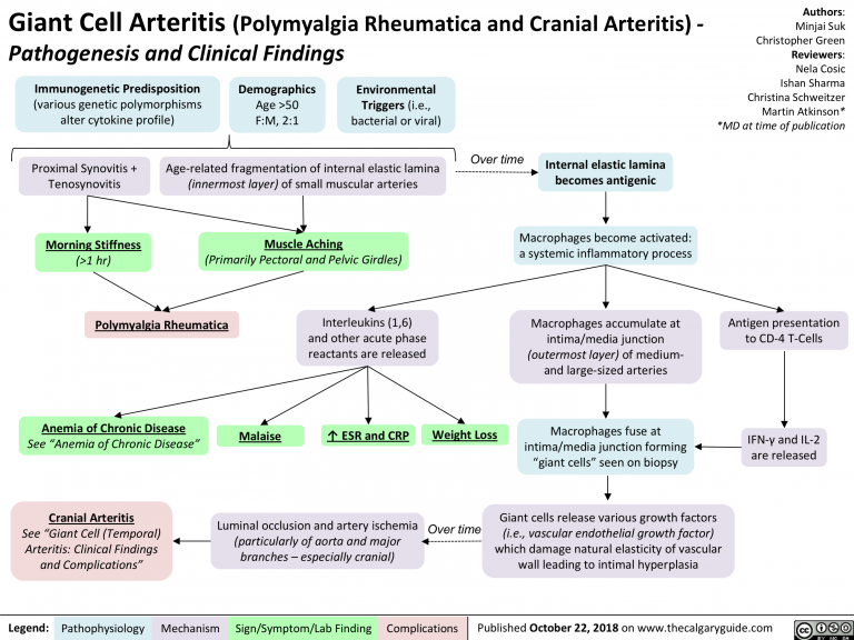 Giant Cell Arteritis: Pathogenesis and Clinical Findings | Calgary Guide