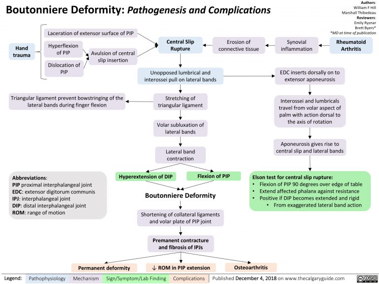 Boutonniere Deformity: Pathogenesis and Complications | Calgary Guide