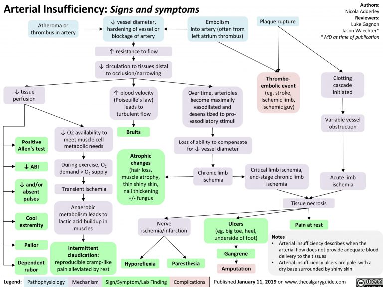 Arterial Insufficiency: Signs and symptoms | Calgary Guide