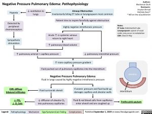 Negative Pressure Pulmonary Edema Pathophysiology