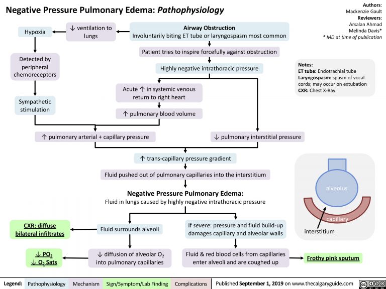 negative-pressure-pulmonary-edema-pathophysiology-calgary-guide