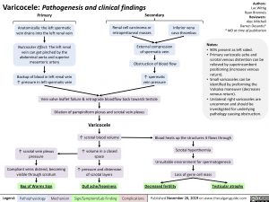 Varicocele: Pathogenesis and clinical findings