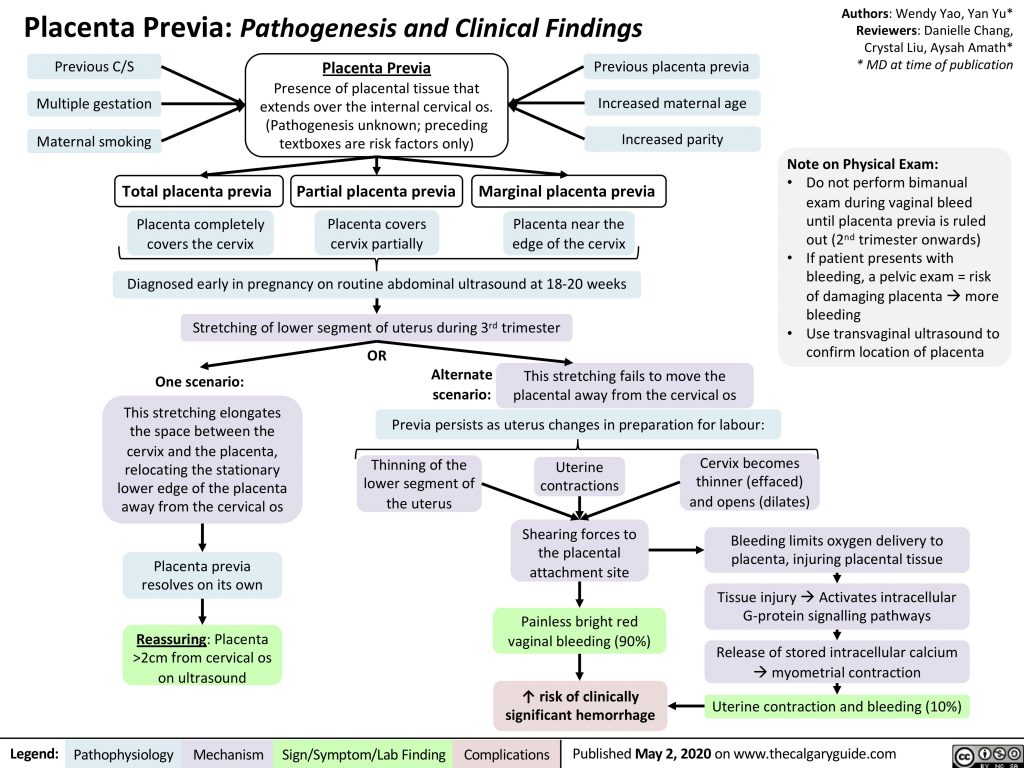 placenta-previa-pathogenesis-and-clinical-findings-calgary-guide