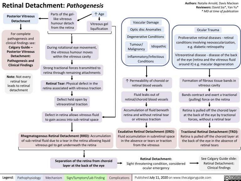 Retinal Detachment: Pathogenesis | Calgary Guide