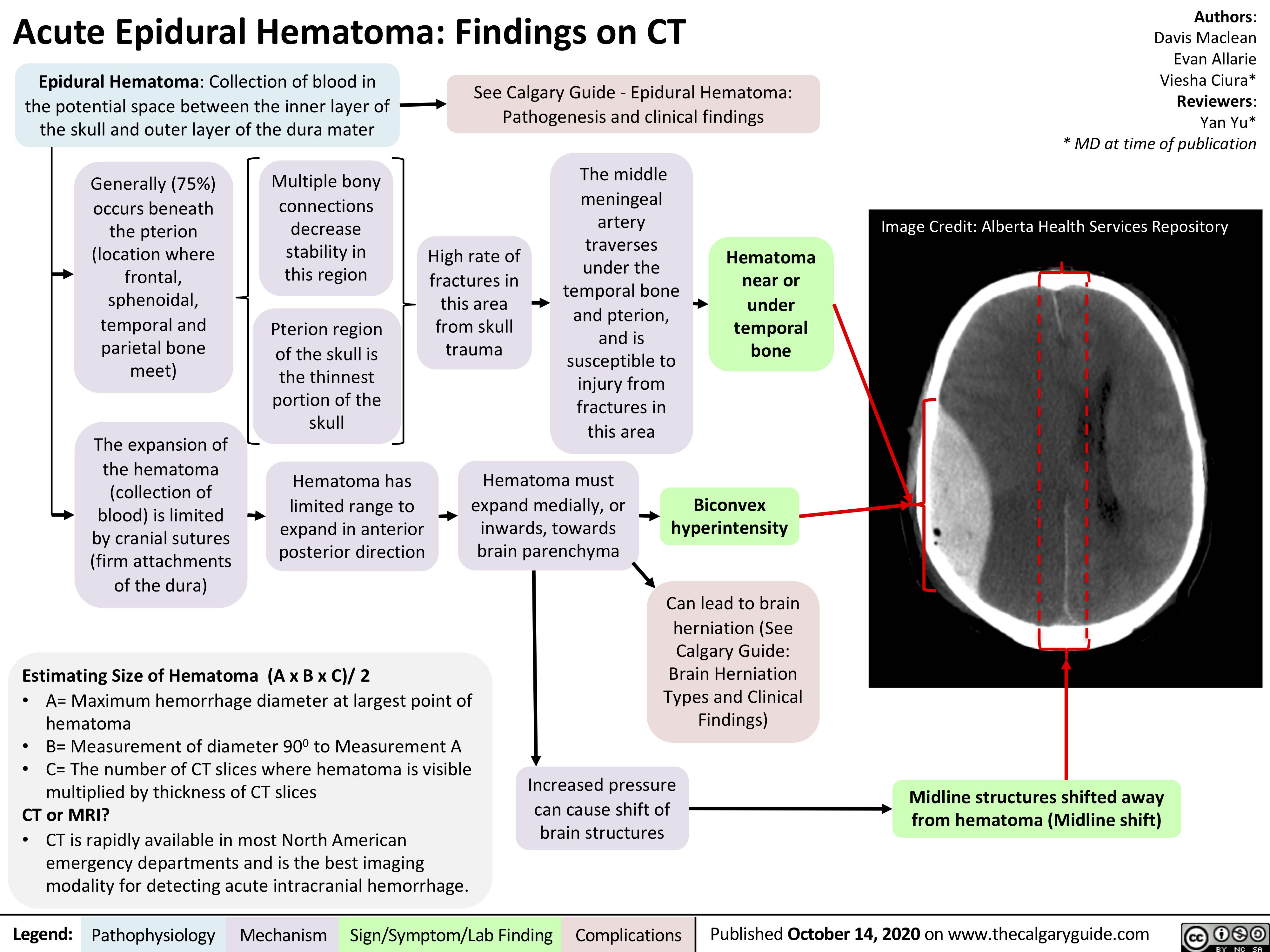 epidural-hematoma-findings-on-ct-calgary-guide