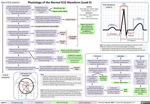 Physiology of the Normal ECG Waveform (Lead II)