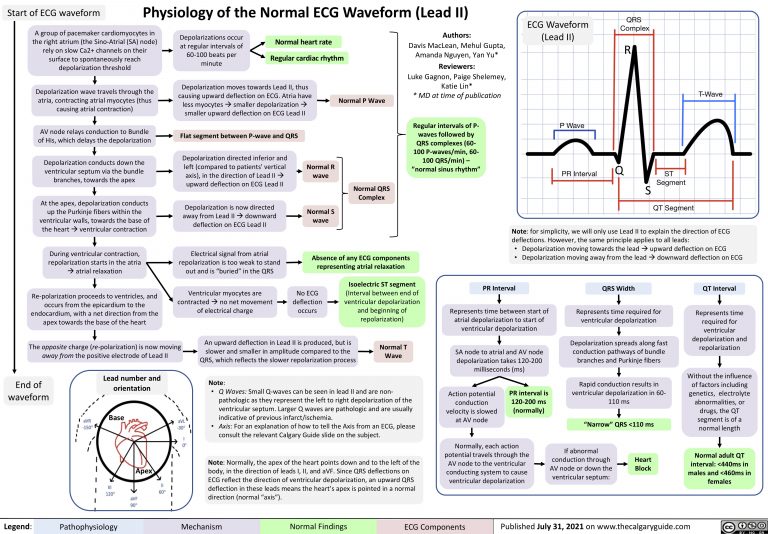 Physiology-of-the-Normal-ECG-Waveform-Lead-II | Calgary Guide