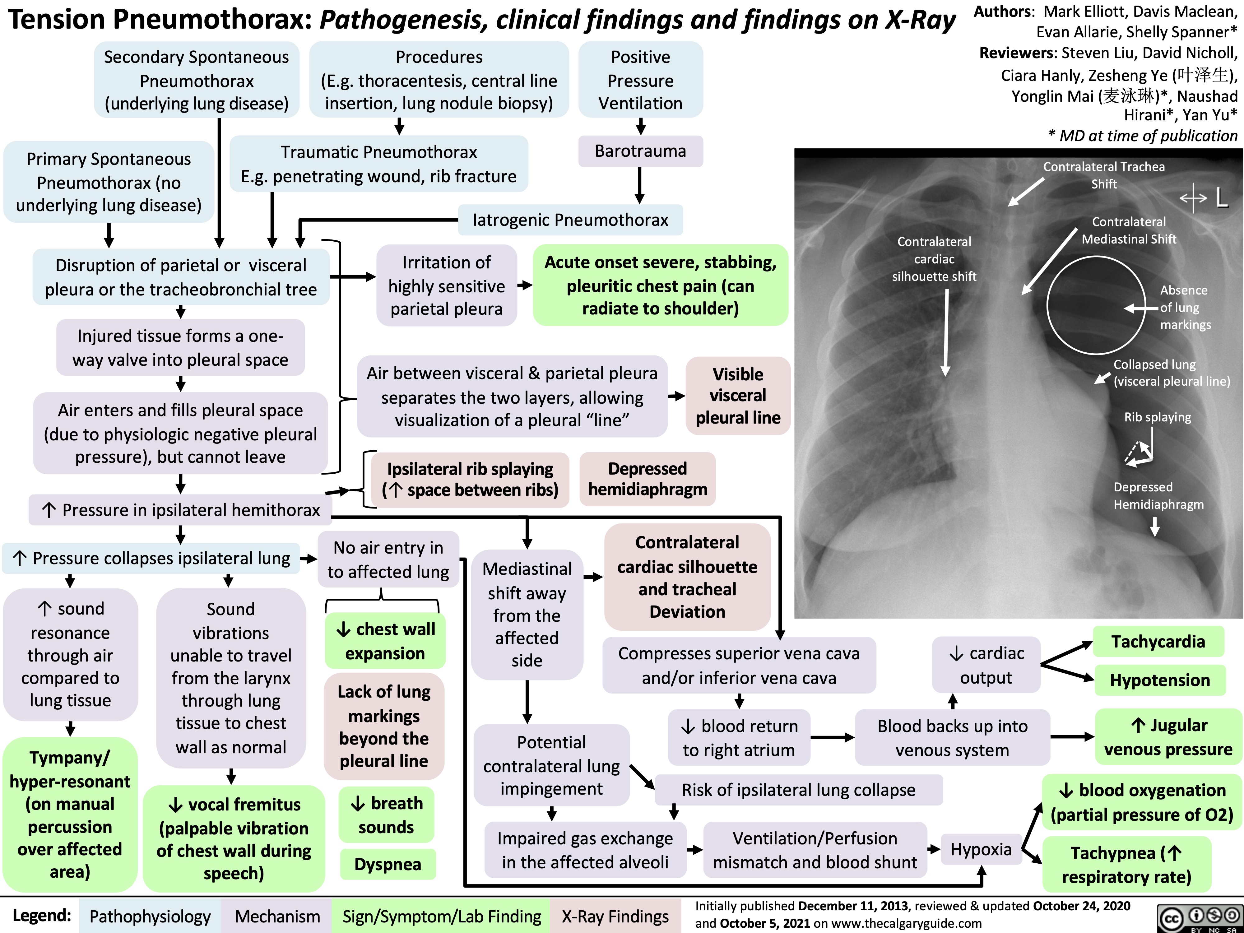 Tension Pneumothorax Calgary Guide