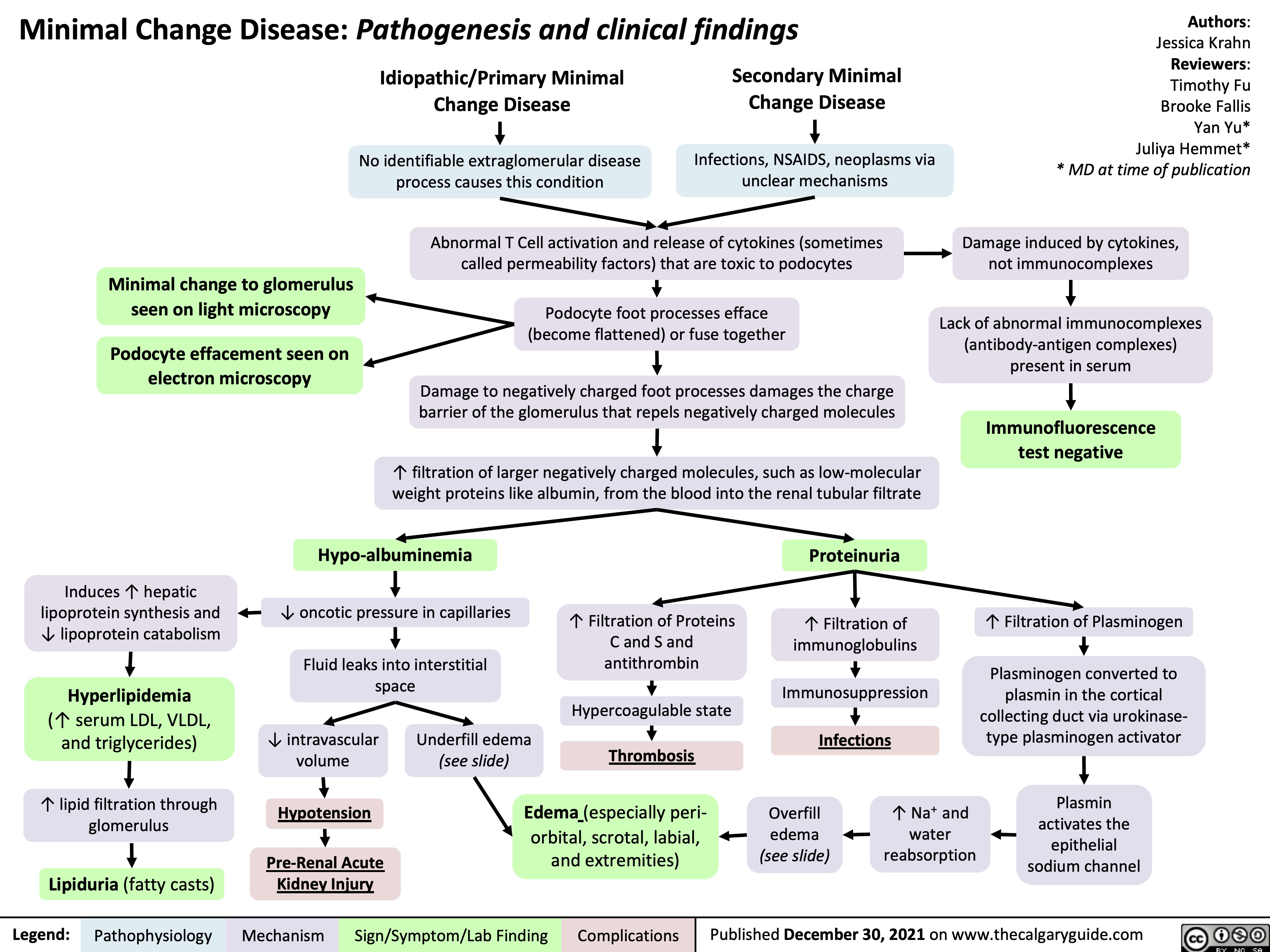 Minimal Change Disease: Pathogenesis and clinical findings
Authors: Jessica Krahn Reviewers: Timothy Fu Brooke Fallis Yan Yu* Juliya Hemmet* * MD at time of publication
Damage induced by cytokines, not immunocomplexes
Lack of abnormal immunocomplexes (antibody-antigen complexes) present in serum
Immunofluorescence test negative
Idiopathic/Primary Minimal Change Disease
No identifiable extraglomerular disease process causes this condition
Secondary Minimal Change Disease
Infections, NSAIDS, neoplasms via unclear mechanisms
       Minimal change to glomerulus seen on light microscopy
Podocyte effacement seen on electron microscopy
Abnormal T Cell activation and release of cytokines (sometimes called permeability factors) that are toxic to podocytes
Podocyte foot processes efface (become flattened) or fuse together
Damage to negatively charged foot processes damages the charge barrier of the glomerulus that repels negatively charged molecules
↑ filtration of larger negatively charged molecules, such as low-molecular weight proteins like albumin, from the blood into the renal tubular filtrate
              Induces ↑ hepatic lipoprotein synthesis and ↓ lipoprotein catabolism
Hyperlipidemia
(↑ serum LDL, VLDL, and triglycerides)
↑ lipid filtration through glomerulus
Lipiduria (fatty casts)
Hypo-albuminemia
↓ oncotic pressure in capillaries
Fluid leaks into interstitial space
↑ Filtration of Proteins C and S and antithrombin
Hypercoagulable state
Proteinuria
↑ Filtration of immunoglobulins
Immunosuppression
Infections
↑ Filtration of Plasminogen
Plasminogen converted to plasmin in the cortical collecting duct via urokinase- type plasminogen activator
Plasmin activates the epithelial sodium channel
             ↓ intravascular volume
Hypotension
Pre-Renal Acute Kidney Injury
Underfill edema
  (see slide)
Thrombosis Edema (especially peri-
orbital, scrotal, labial, and extremities)
        Overfill
edema
(see slide)
↑ Na+ and water reabsorption
    Legend:
 Pathophysiology
Mechanism
Sign/Symptom/Lab Finding
 Complications
Published December 30, 2021 on www.thecalgaryguide.com
    