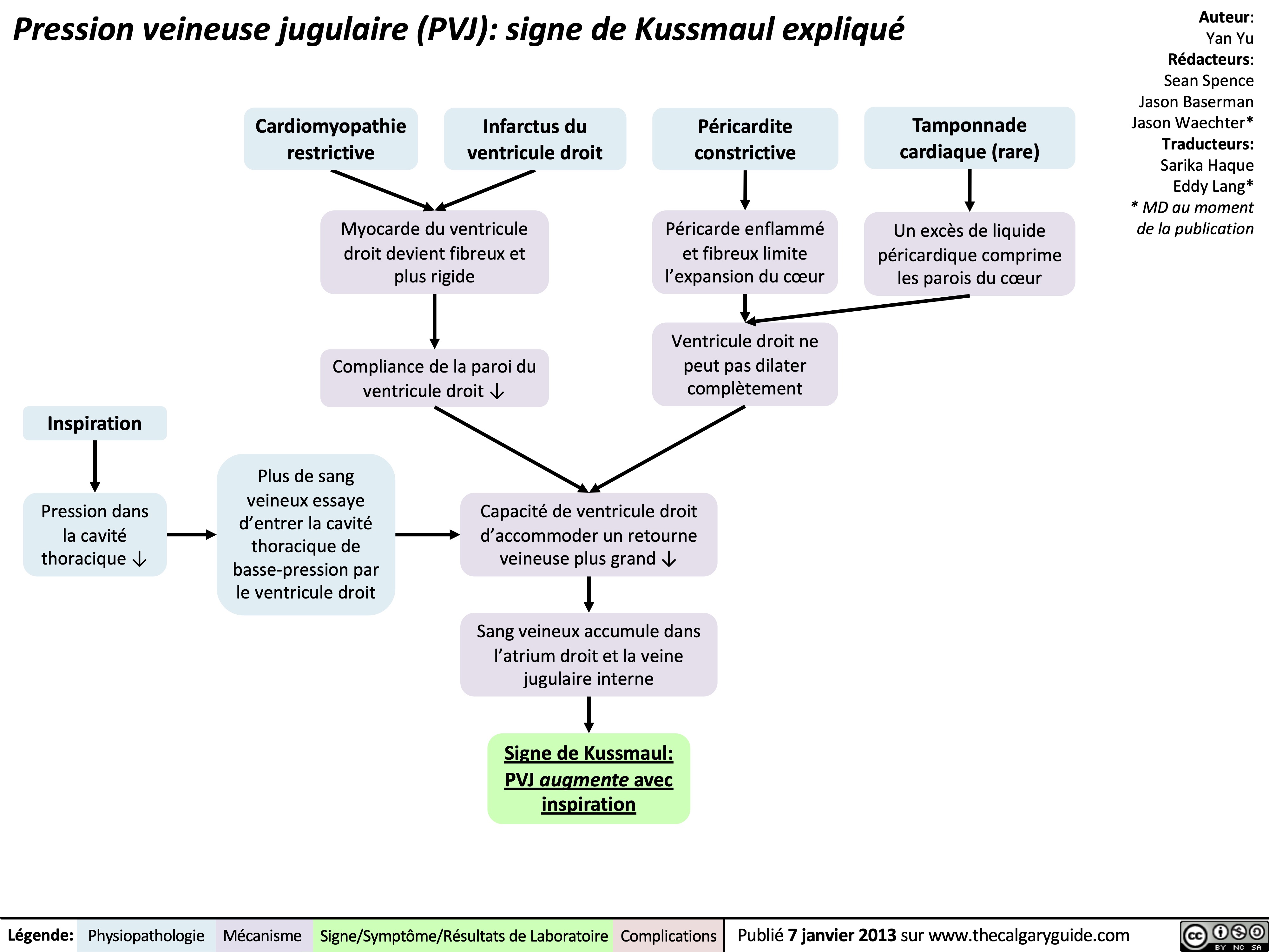 Pression veineuse jugulaire (PVJ): signe de Kussmaul expliqué