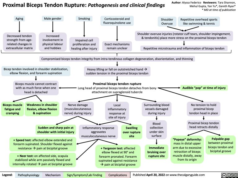 Proximal Biceps Tendon Rupture | Calgary Guide