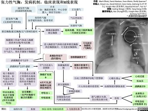 张力性气胸发病机制，临床表现和x线表现