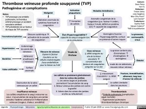 thrombose-veineuse-profonde-soupconne-tvp-pathogenese-et-complications