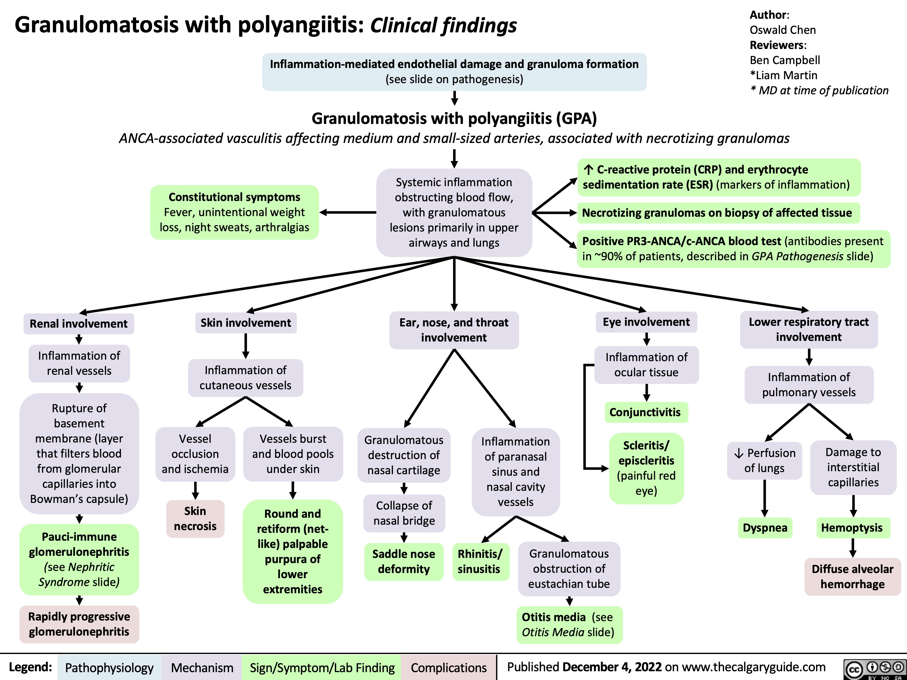 Granulomatosis with polyangiitis: Clinical findings Inflammation-mediated endothelial damage and granuloma formation
(see slide on pathogenesis)
Granulomatosis with polyangiitis (GPA)
Author:
Oswald Chen
Reviewers:
Ben Campbell
*Liam Martin
* MD at time of publication
 ANCA-associated vasculitis affecting medium and small-sized arteries, associated with necrotizing granulomas
    Constitutional symptoms
Fever, unintentional weight loss, night sweats, arthralgias
Skin involvement
Inflammation of cutaneous vessels
Systemic inflammation obstructing blood flow, with granulomatous lesions primarily in upper airways and lungs
Ear, nose, and throat involvement
↑ C-reactive protein (CRP) and erythrocyte sedimentation rate (ESR) (markers of inflammation)
Necrotizing granulomas on biopsy of affected tissue
Positive PR3-ANCA/c-ANCA blood test (antibodies present in ~90% of patients, described in GPA Pathogenesis slide)
             Renal involvement
Inflammation of renal vessels
Rupture of basement membrane (layer that filters blood from glomerular capillaries into Bowman’s capsule)
Pauci-immune glomerulonephritis (see Nephritic Syndrome slide)
Rapidly progressive glomerulonephritis
Eye involvement
Inflammation of ocular tissue
Conjunctivitis
Scleritis/ episcleritis (painful red eye)
Lower respiratory tract involvement
Inflammation of pulmonary vessels
                 Vessel occlusion and ischemia
Skin necrosis
Vessels burst and blood pools under skin
Round and retiform (net- like) palpable purpura of lower extremities
Granulomatous destruction of nasal cartilage
Collapse of nasal bridge
Saddle nose deformity
Inflammation of paranasal sinus and nasal cavity vessels
↓ Perfusion of lungs
Dyspnea
Damage to interstitial capillaries
Hemoptysis
Diffuse alveolar hemorrhage
              Rhinitis/ sinusitis
Granulomatous obstruction of eustachian tube
Otitis media (see Otitis Media slide)
   
Legend:
Pathophysiology
Mechanism
Sign/Symptom/Lab Finding
Complications
Published December 4, 2022 on www.thecalgaryguide.com
 