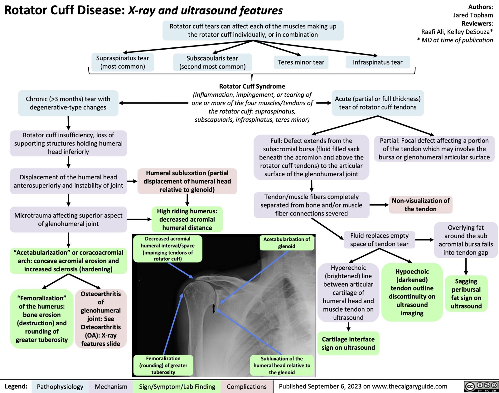 Rotator Cuff Disease: X-ray and ultrasound features | Calgary Guide